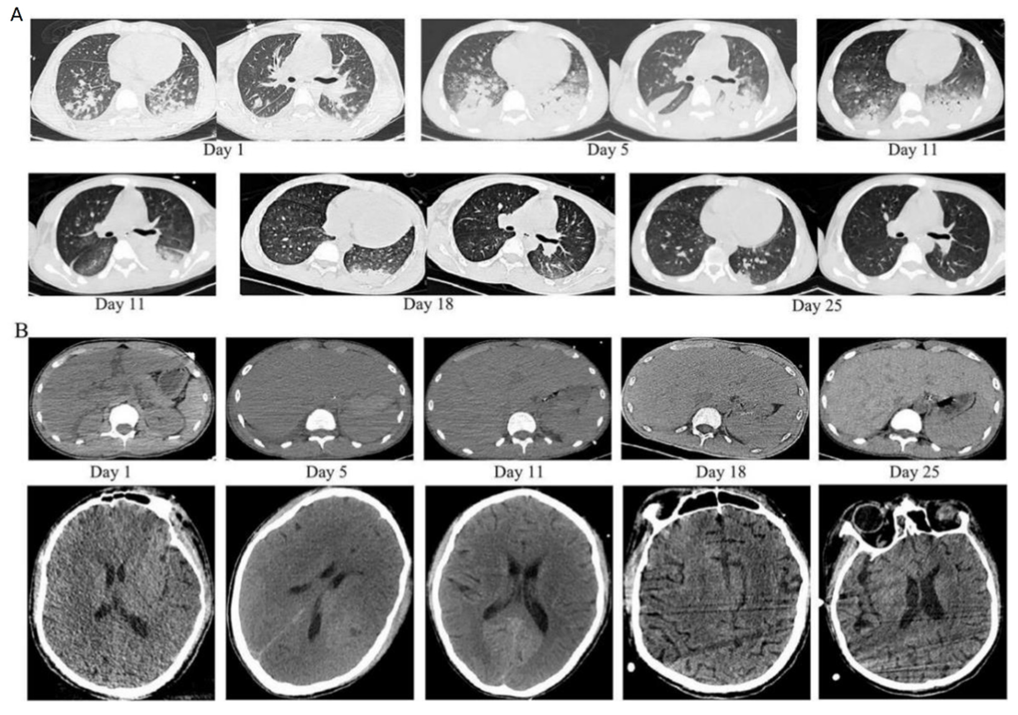 Jcm 12 00095 g001 Jcm 12 00095 g001