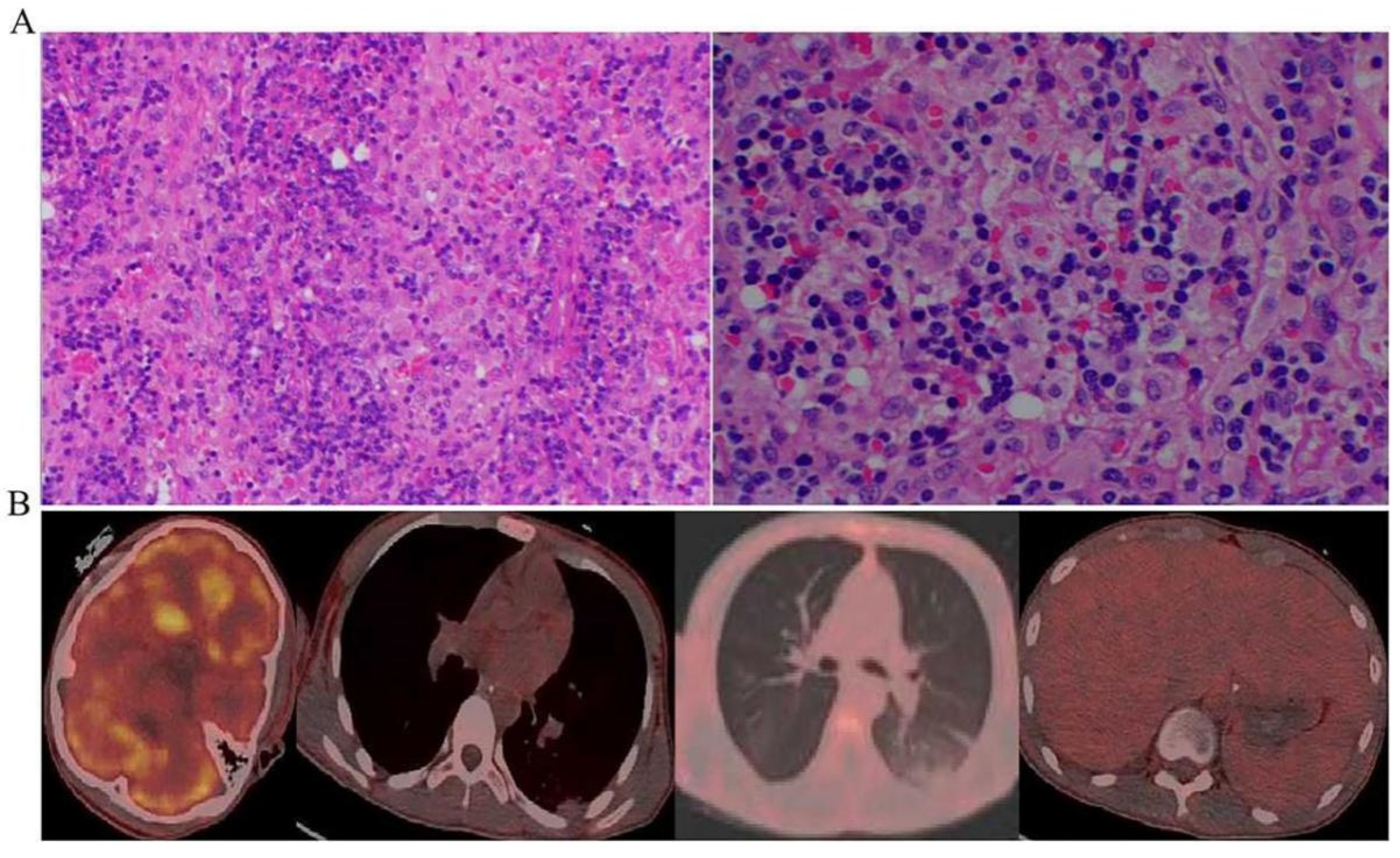 Jcm 12 00095 g003 Jcm 12 00095 g003