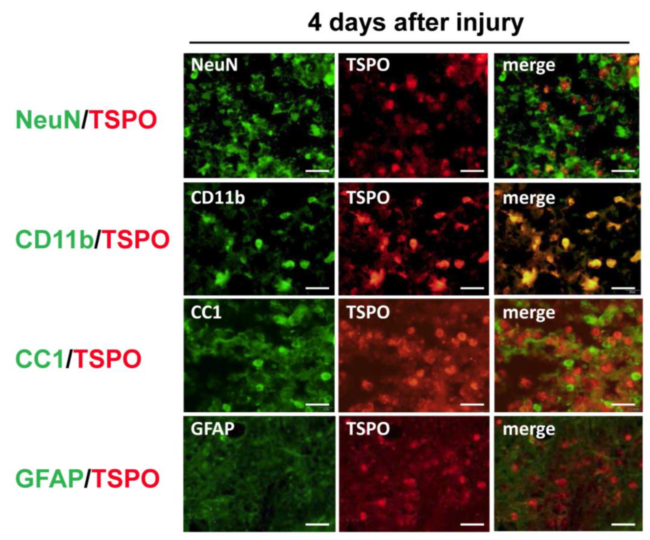 Evaluation of (R)-[11C]PK11195 PET/MRI for Spinal Cord