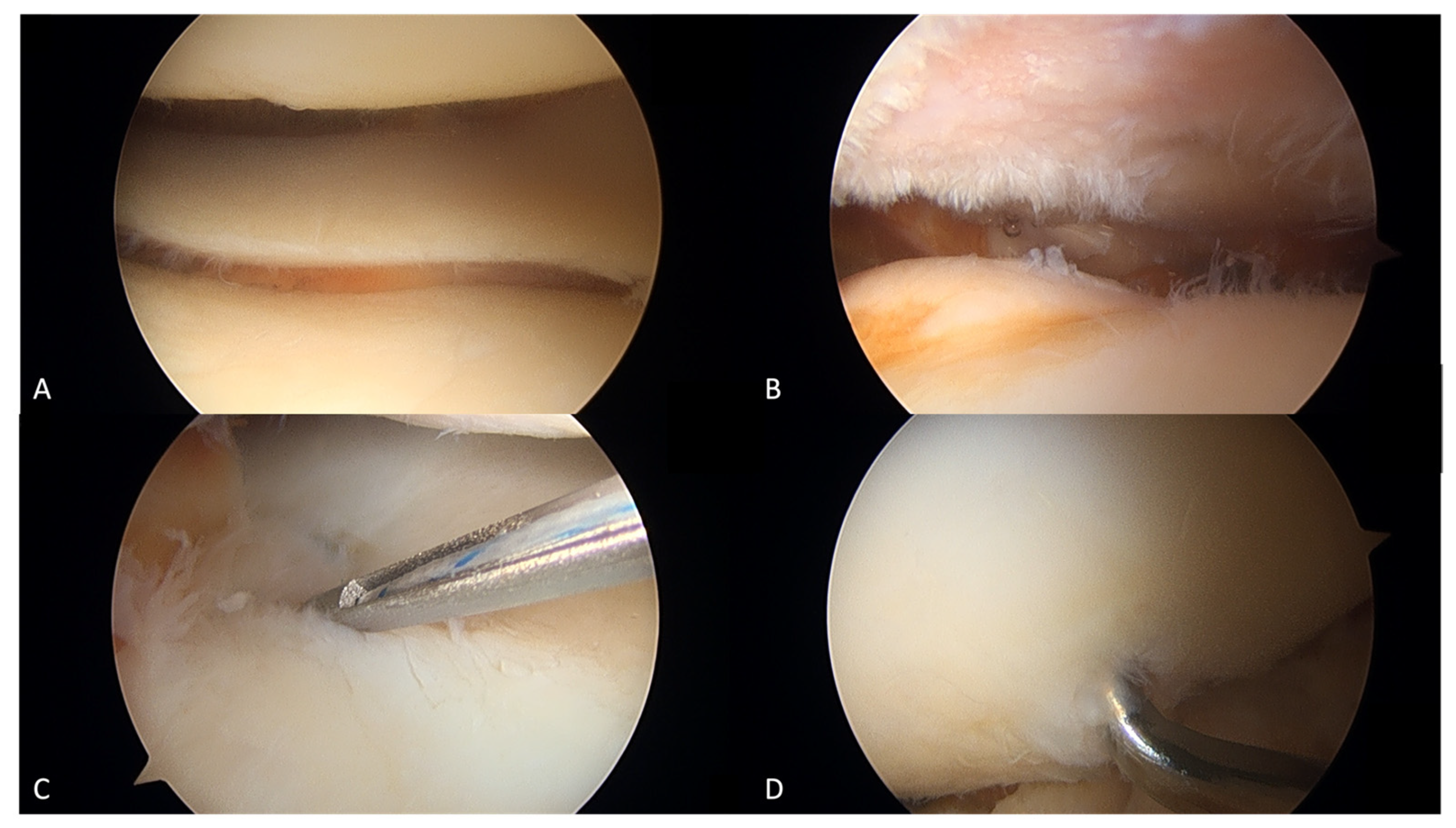 Jcm 12 00176 g003 Jcm 12 00176 g003