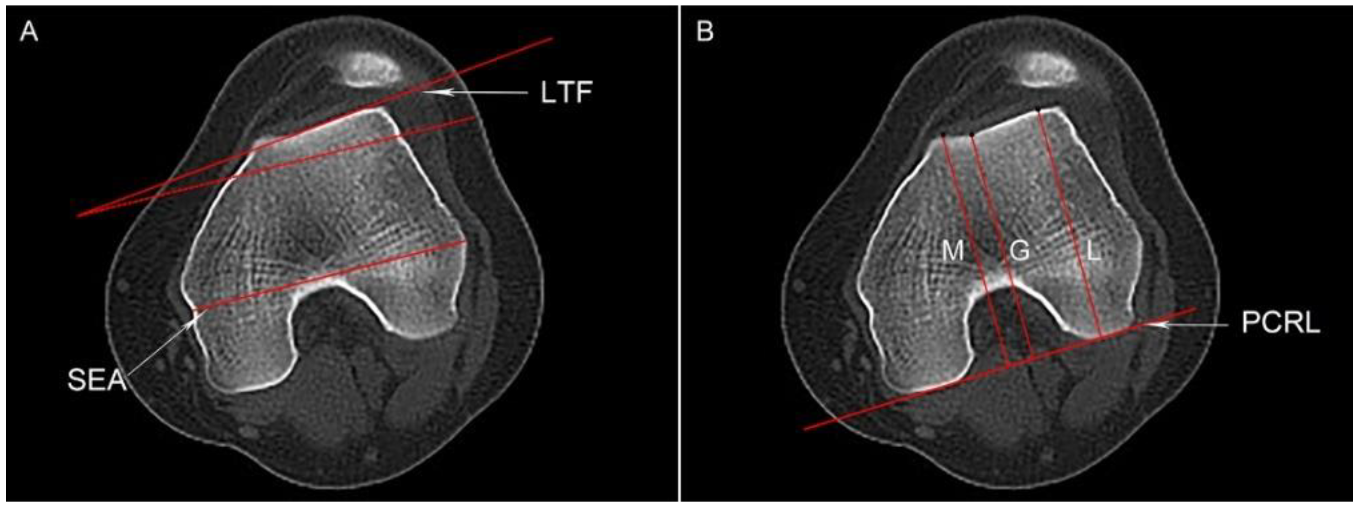 Jcm 12 00180 g001 550