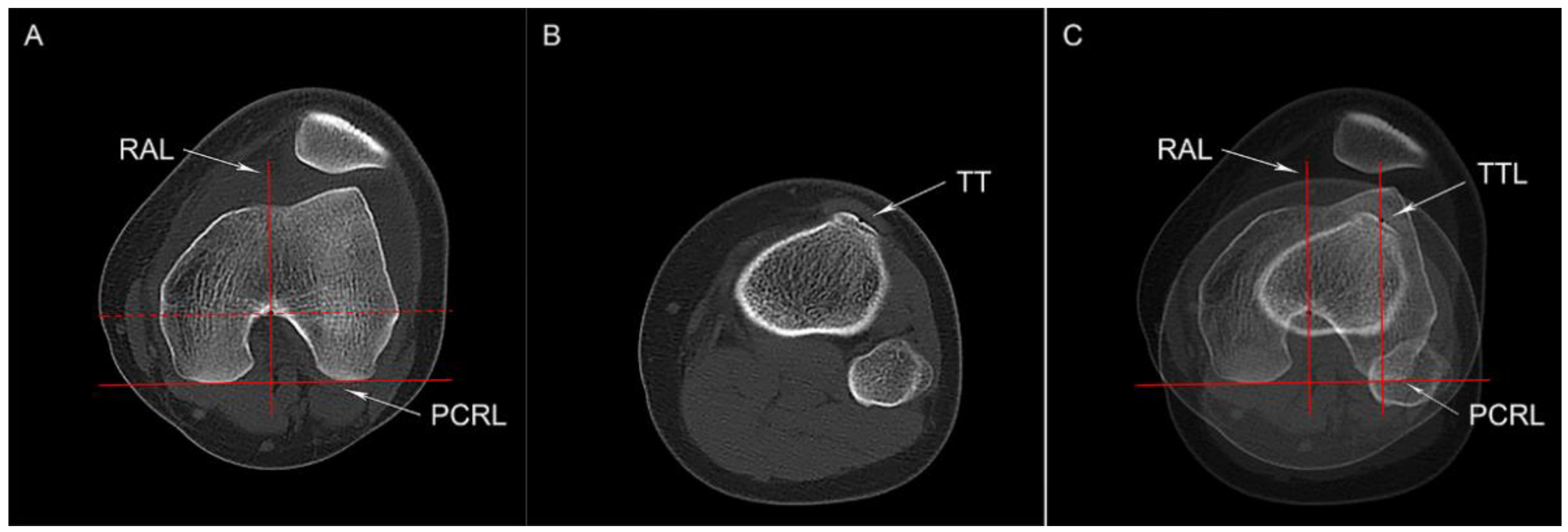 Jcm 12 00180 g002 550