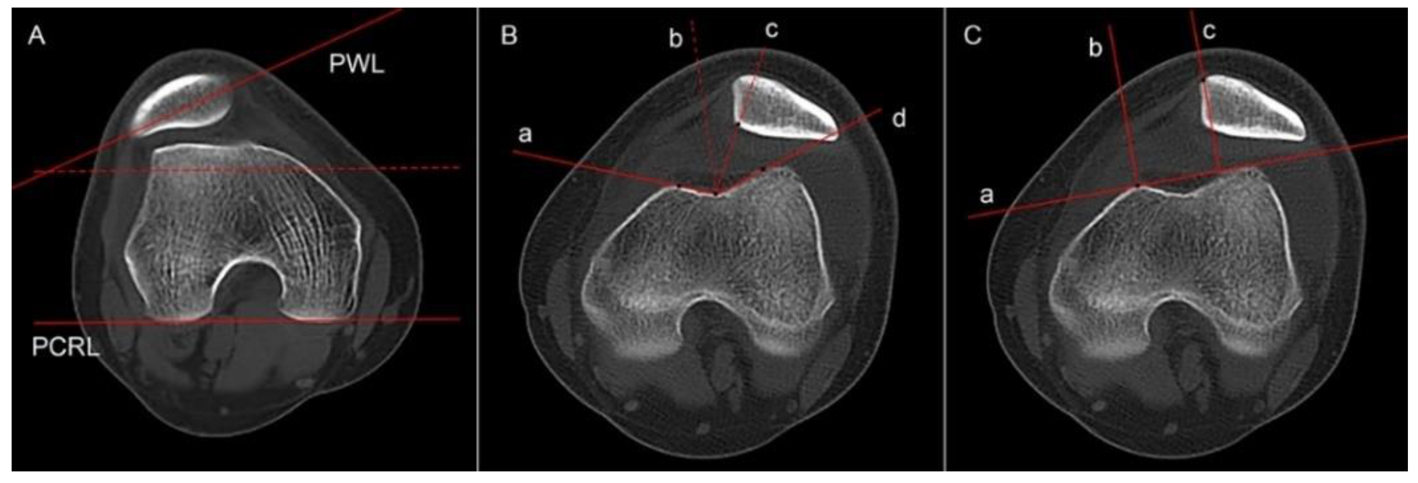 Jcm 12 00180 g004 550