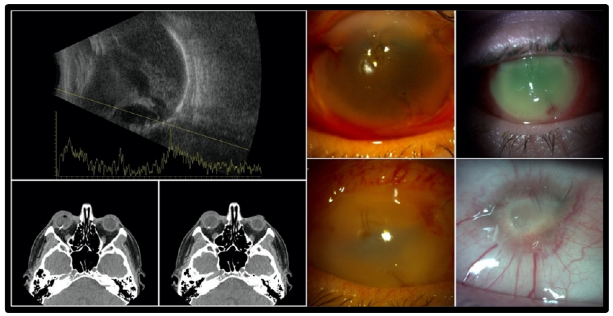 Jcm 12 00190 g001 Jcm 12 00190 g001