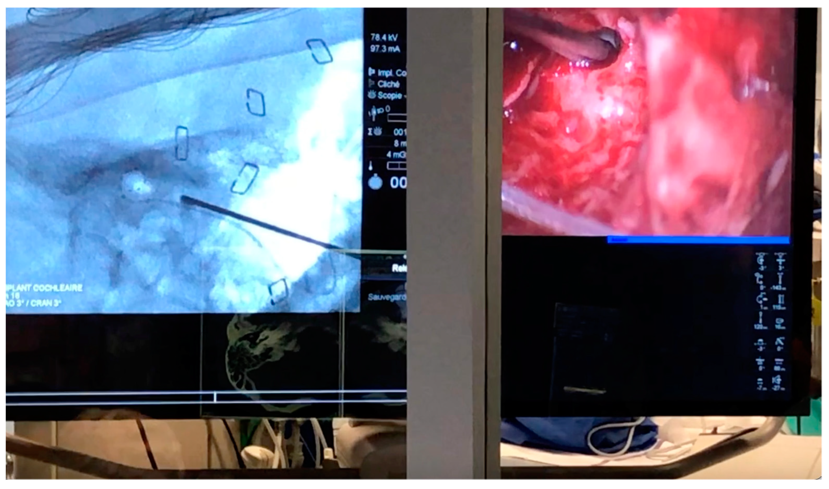 Jcm 12 00211 g004 Jcm 12 00211 g004