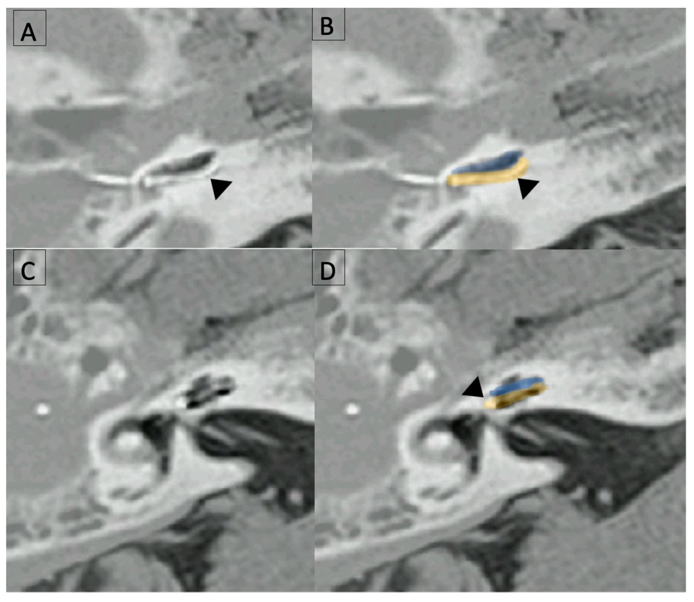 Jcm 12 00211 g005 Jcm 12 00211 g005