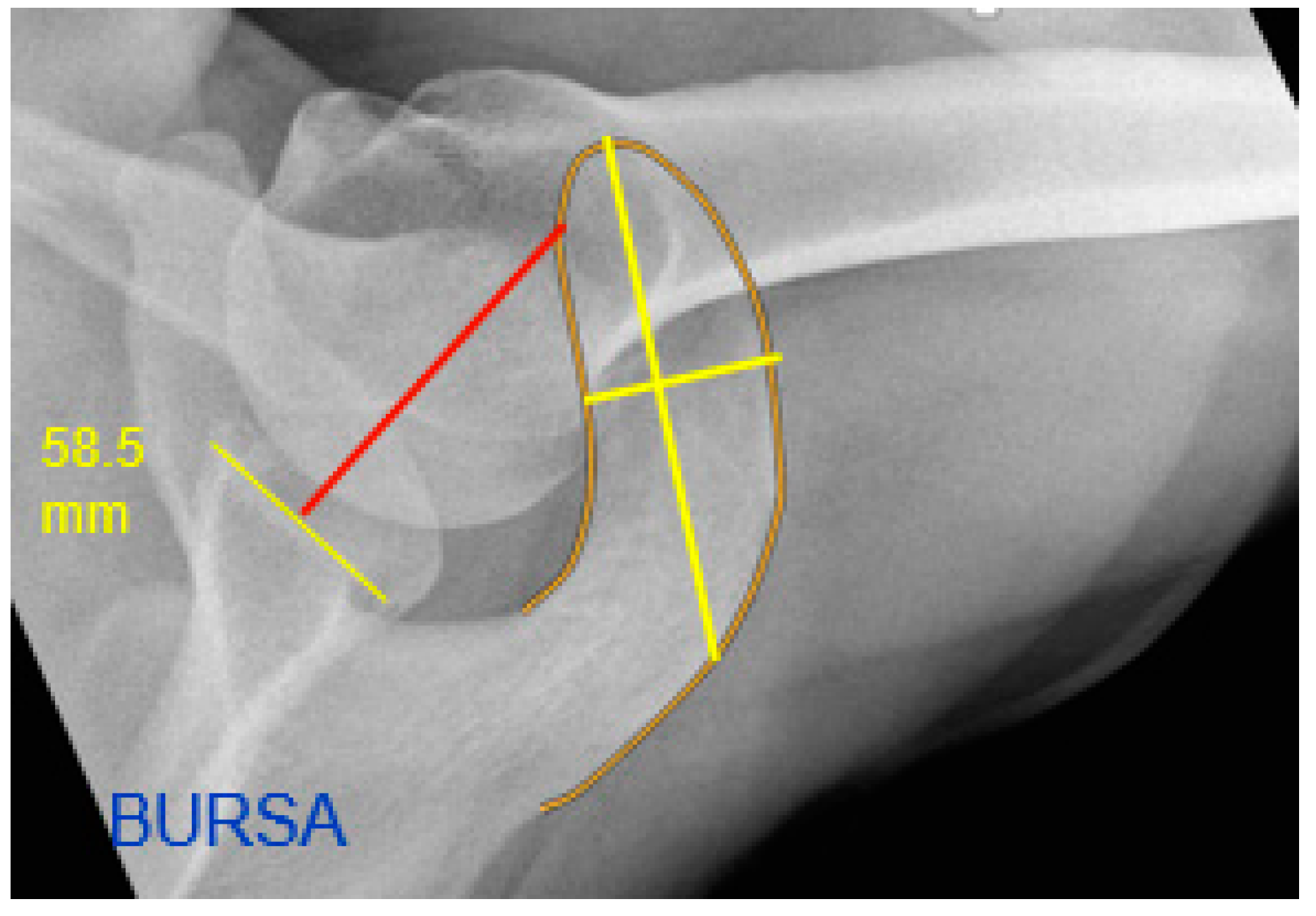 Jcm 12 00233 g004 Jcm 12 00233 g004