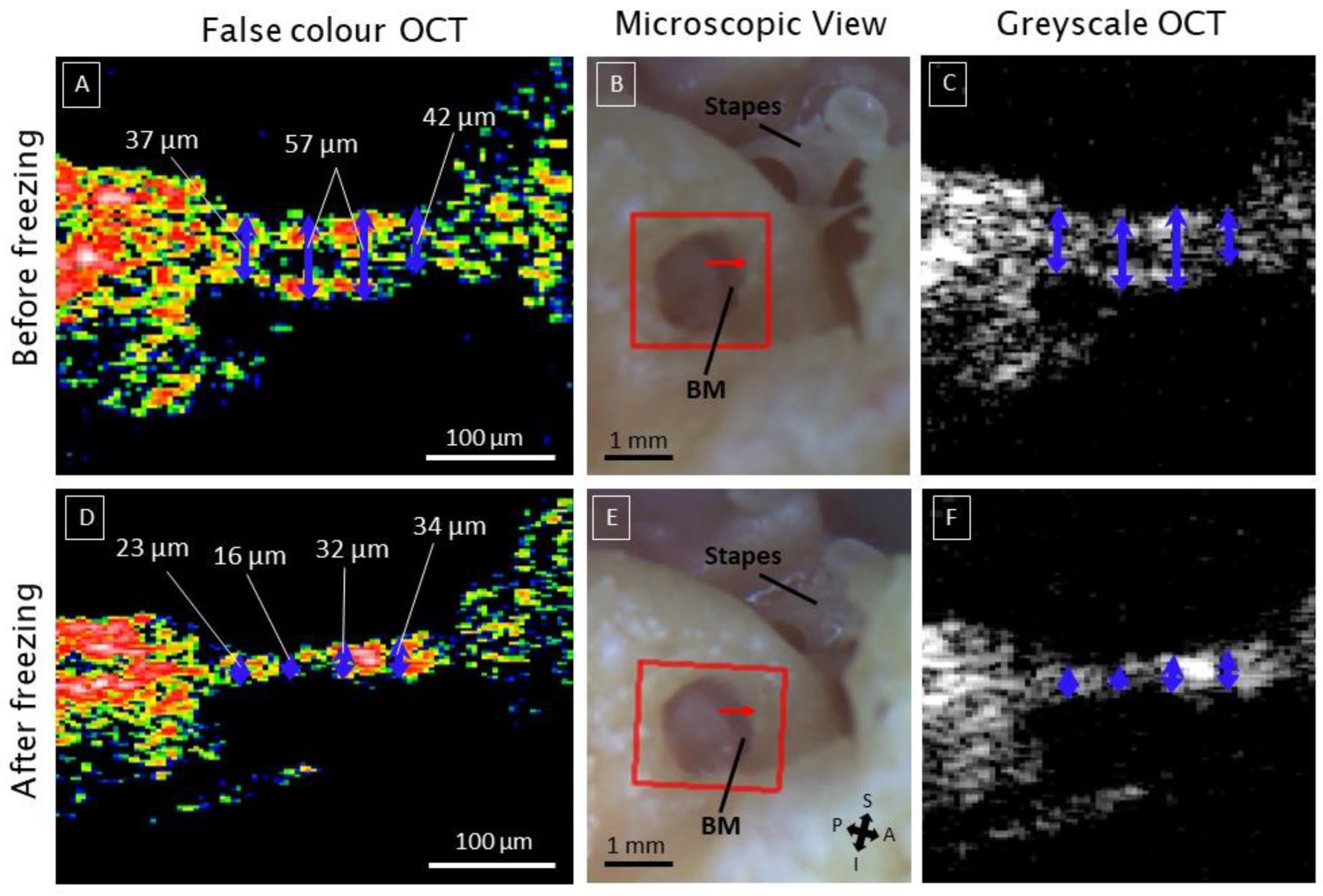 Jcm 12 00238 g004 Jcm 12 00238 g004