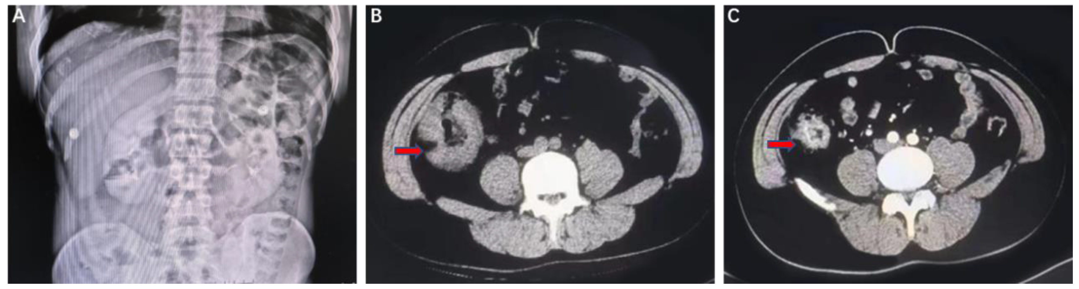Jcm 12 00240 g001 Jcm 12 00240 g001