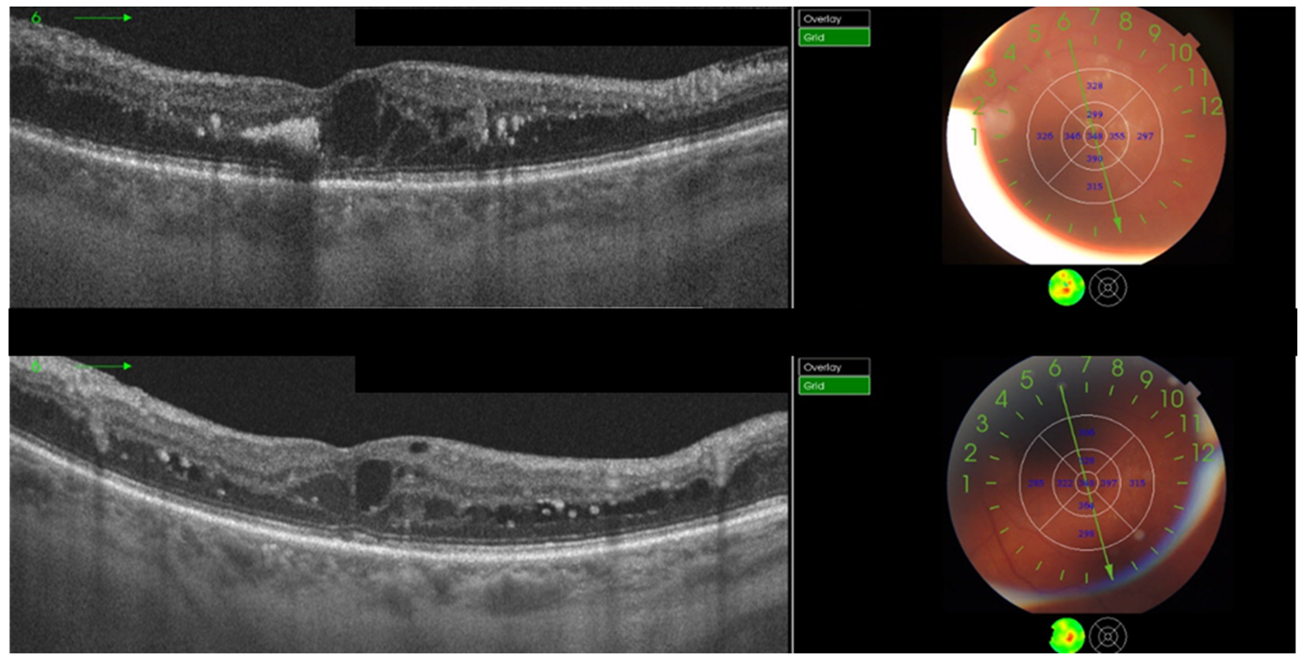 Jcm 12 00274 g001 Jcm 12 00274 g001