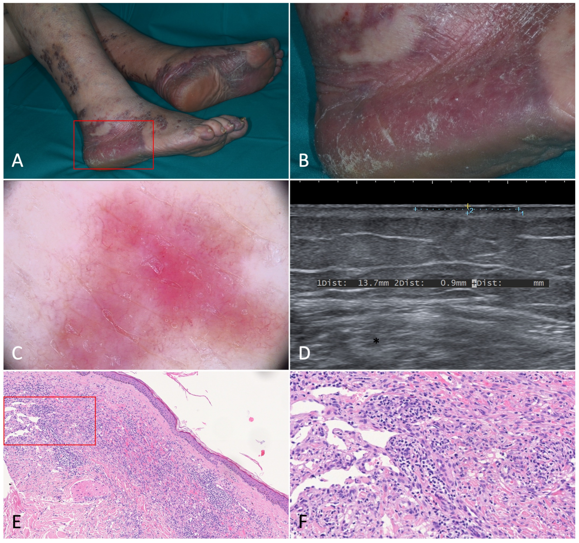 Jcm 12 00278 g001 Jcm 12 00278 g001
