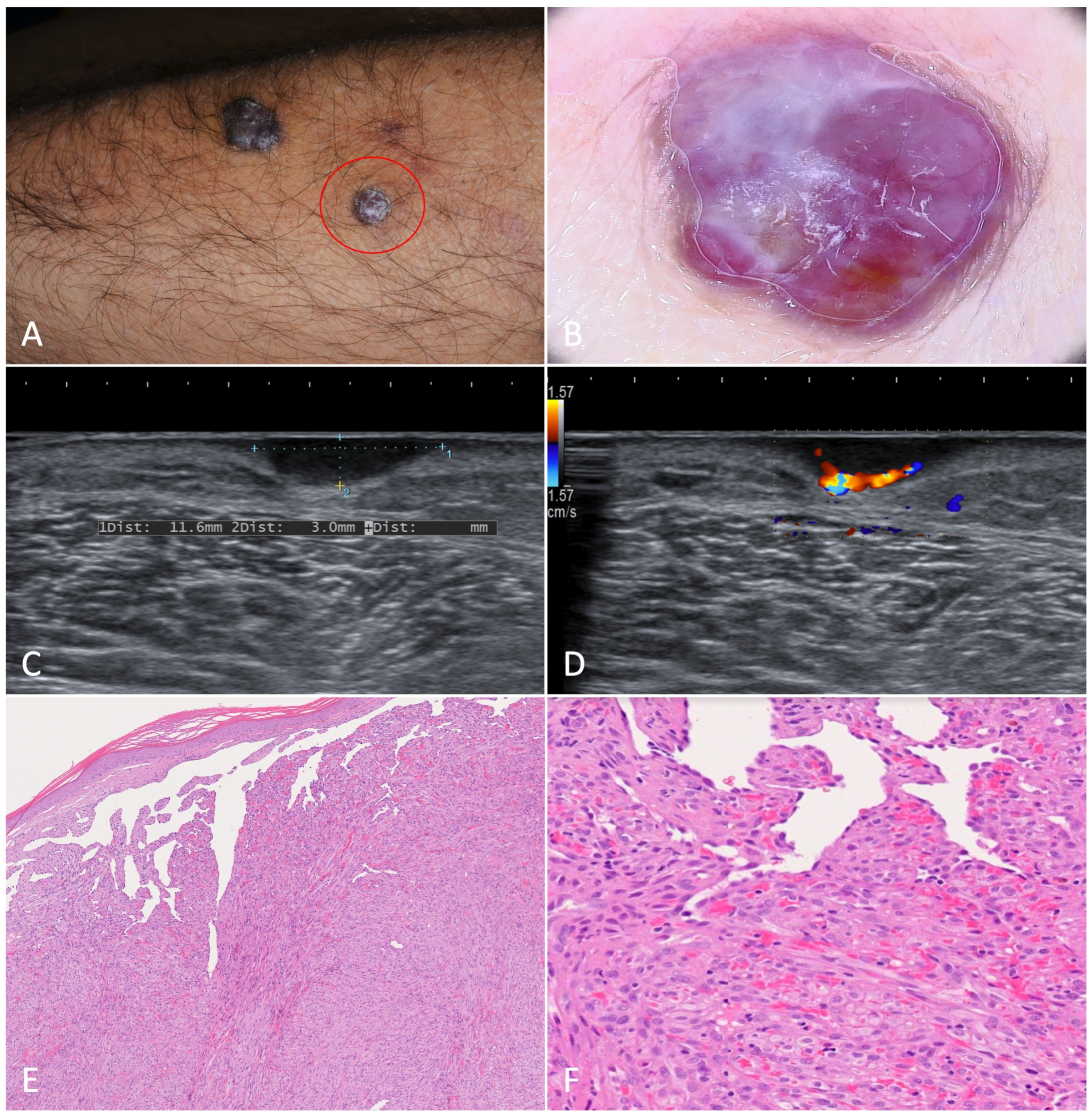 Jcm 12 00278 g003 Jcm 12 00278 g003