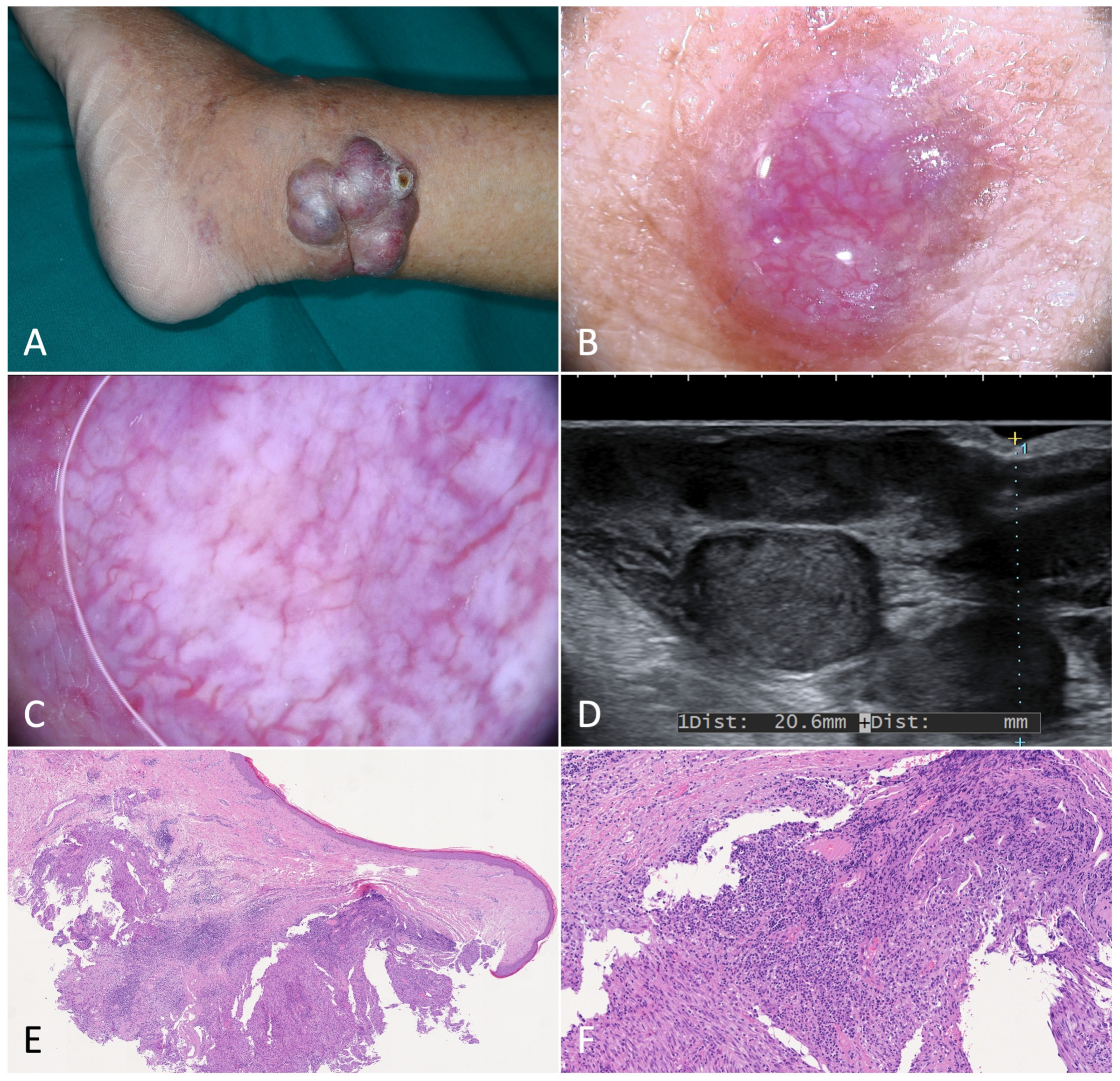 Jcm 12 00278 g004 Jcm 12 00278 g004