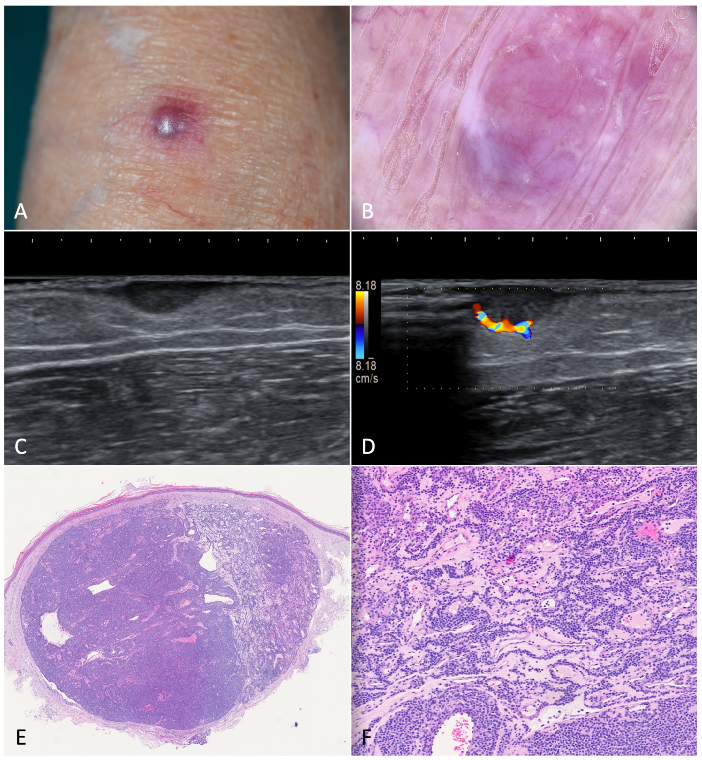 Jcm 12 00278 g006 Jcm 12 00278 g006