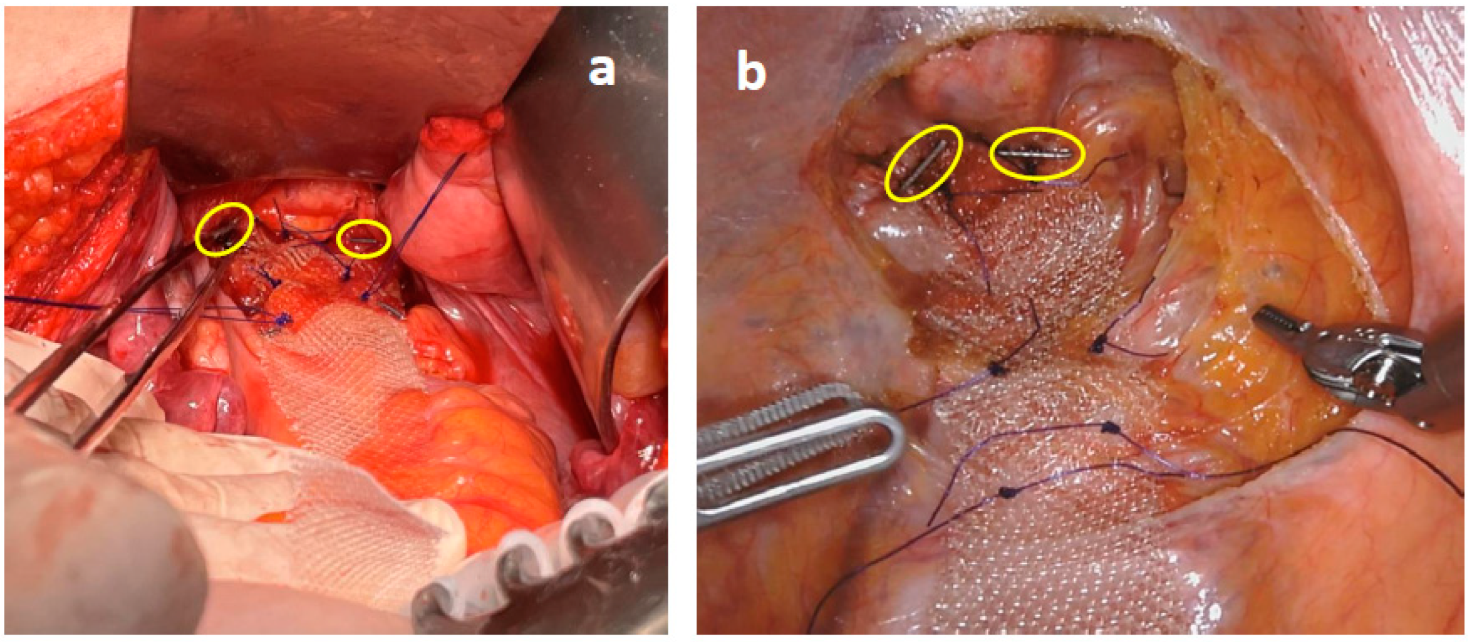 Jcm 12 00294 g003 Jcm 12 00294 g003