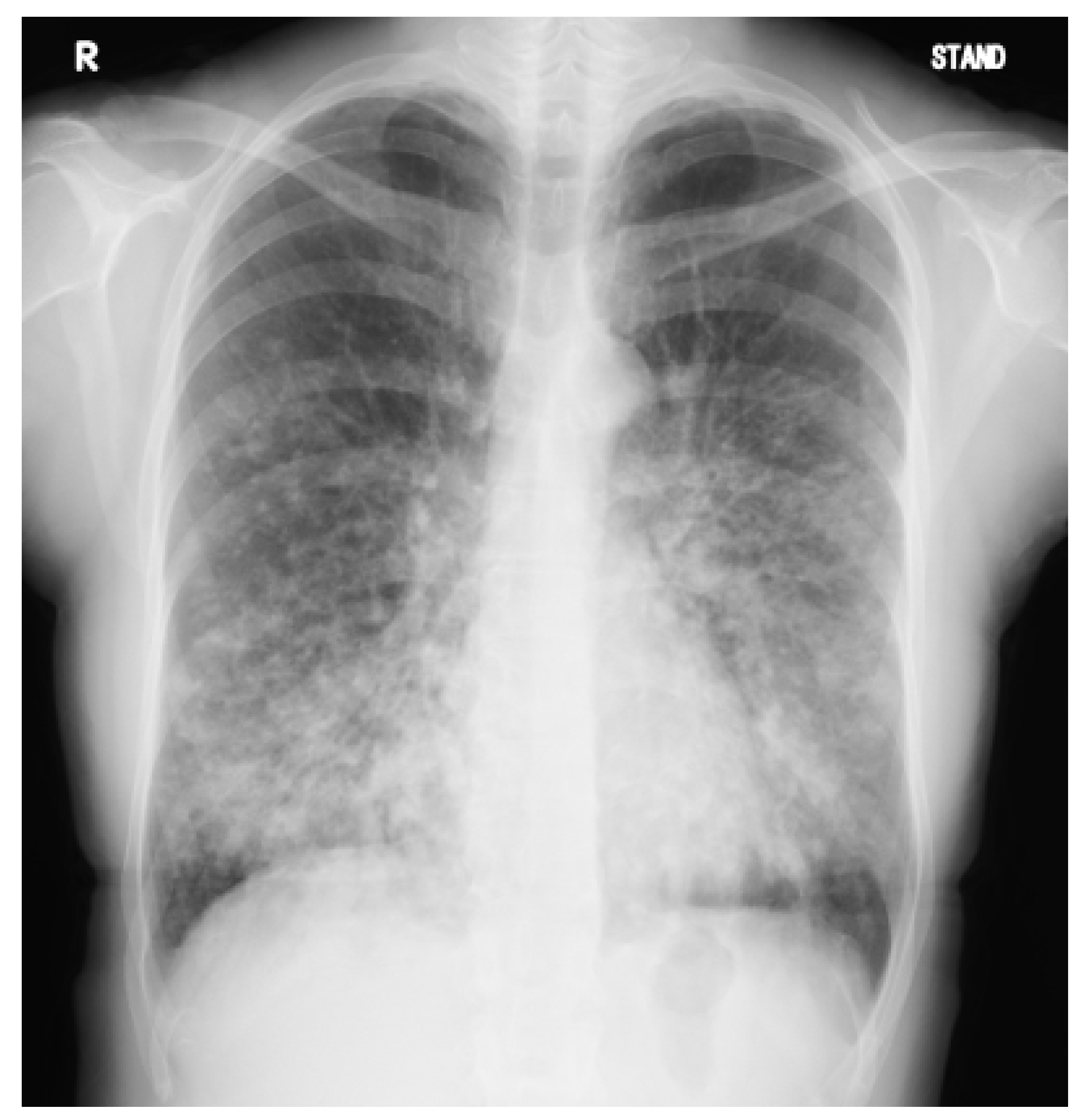 Jcm 12 00317 g001 Jcm 12 00317 g001