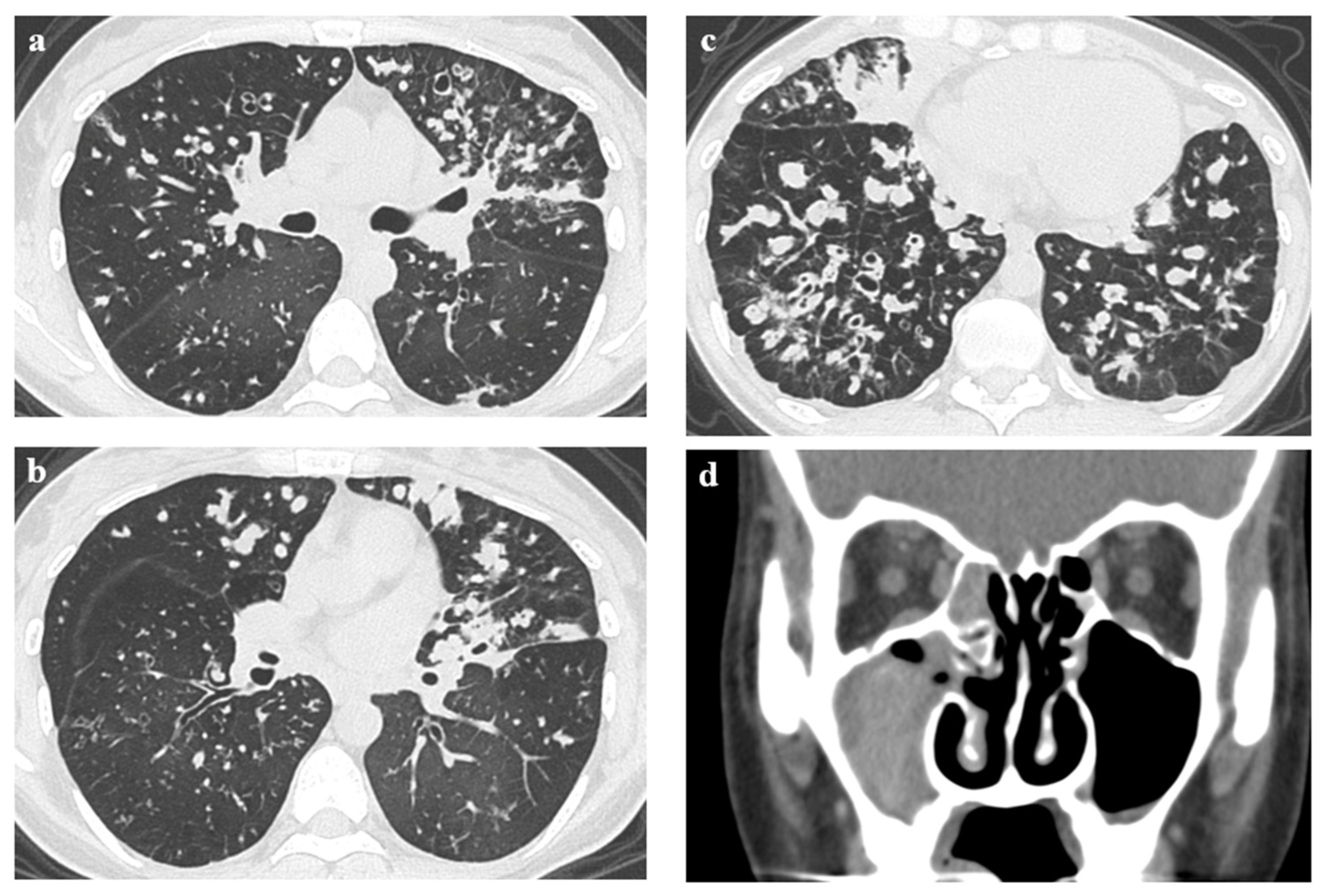 Jcm 12 00317 g002 Jcm 12 00317 g002