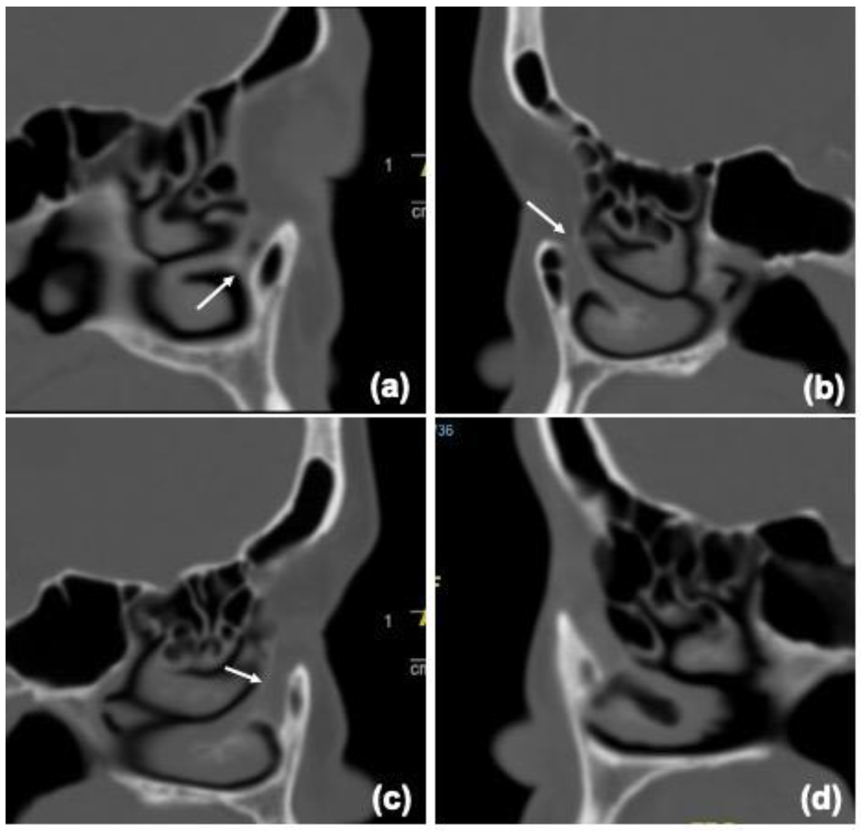 Jcm 12 00340 g002 Jcm 12 00340 g002