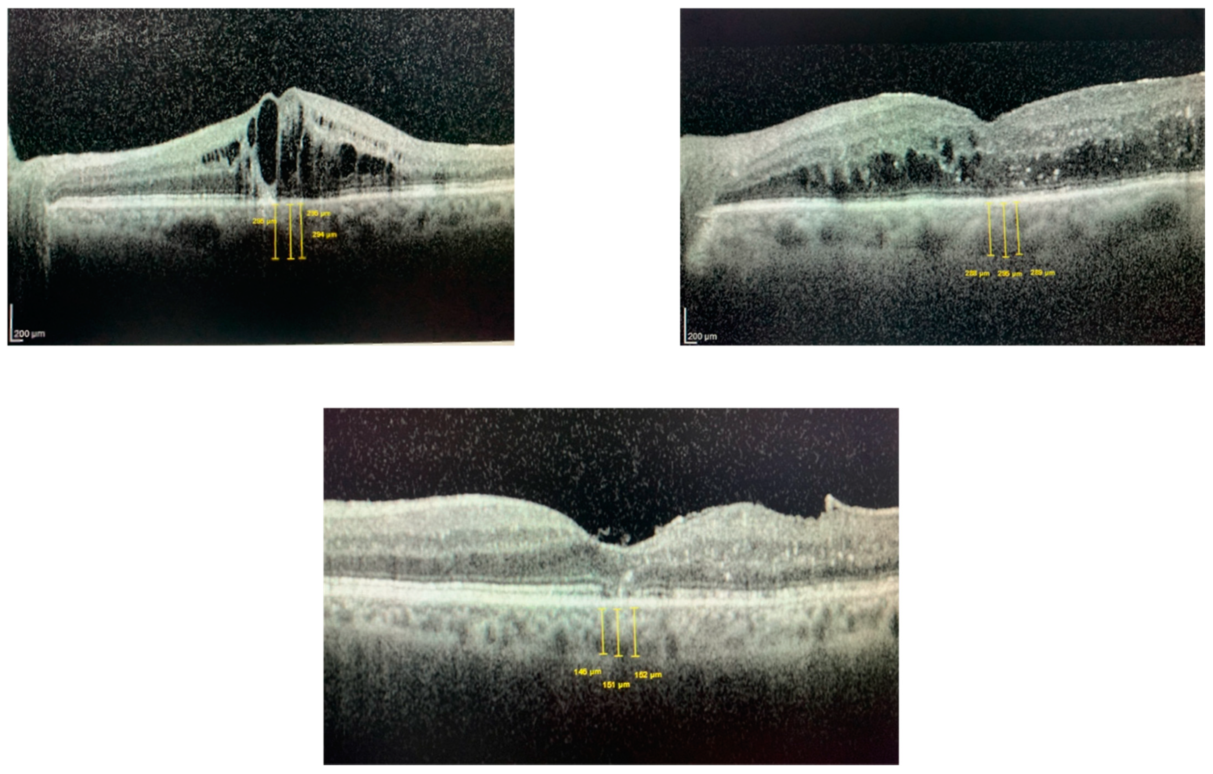 Jcm 12 00348 g001 Jcm 12 00348 g001