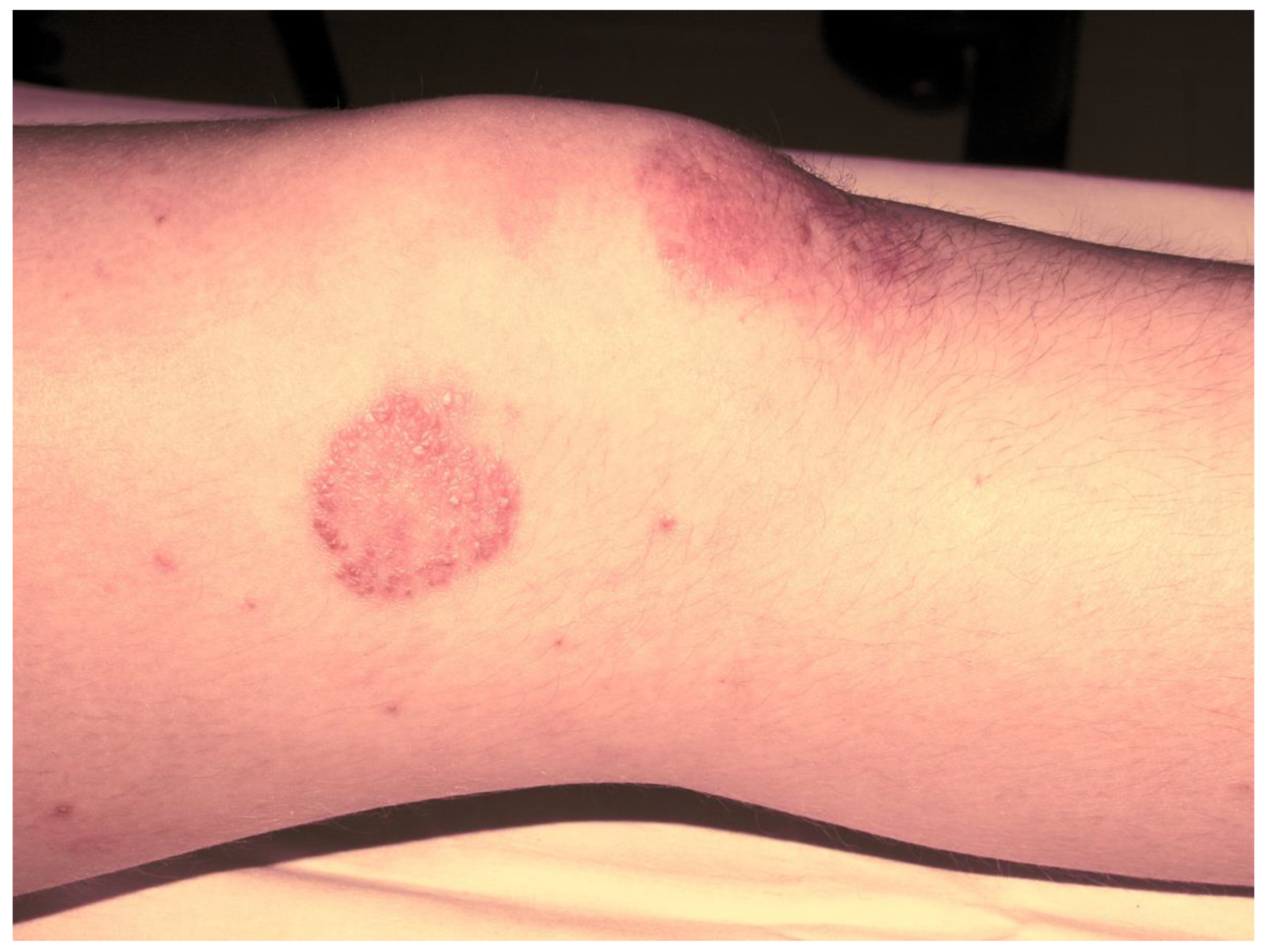 Jcm 12 00367 g001 Jcm 12 00367 g001