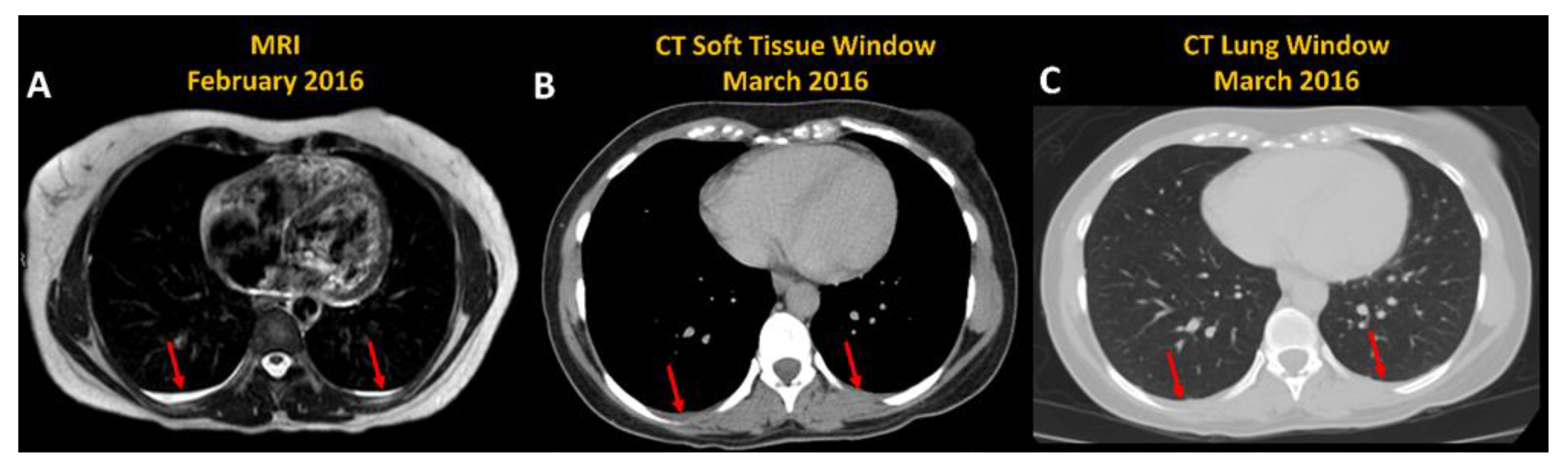Jcm 12 00386 g004 Jcm 12 00386 g004