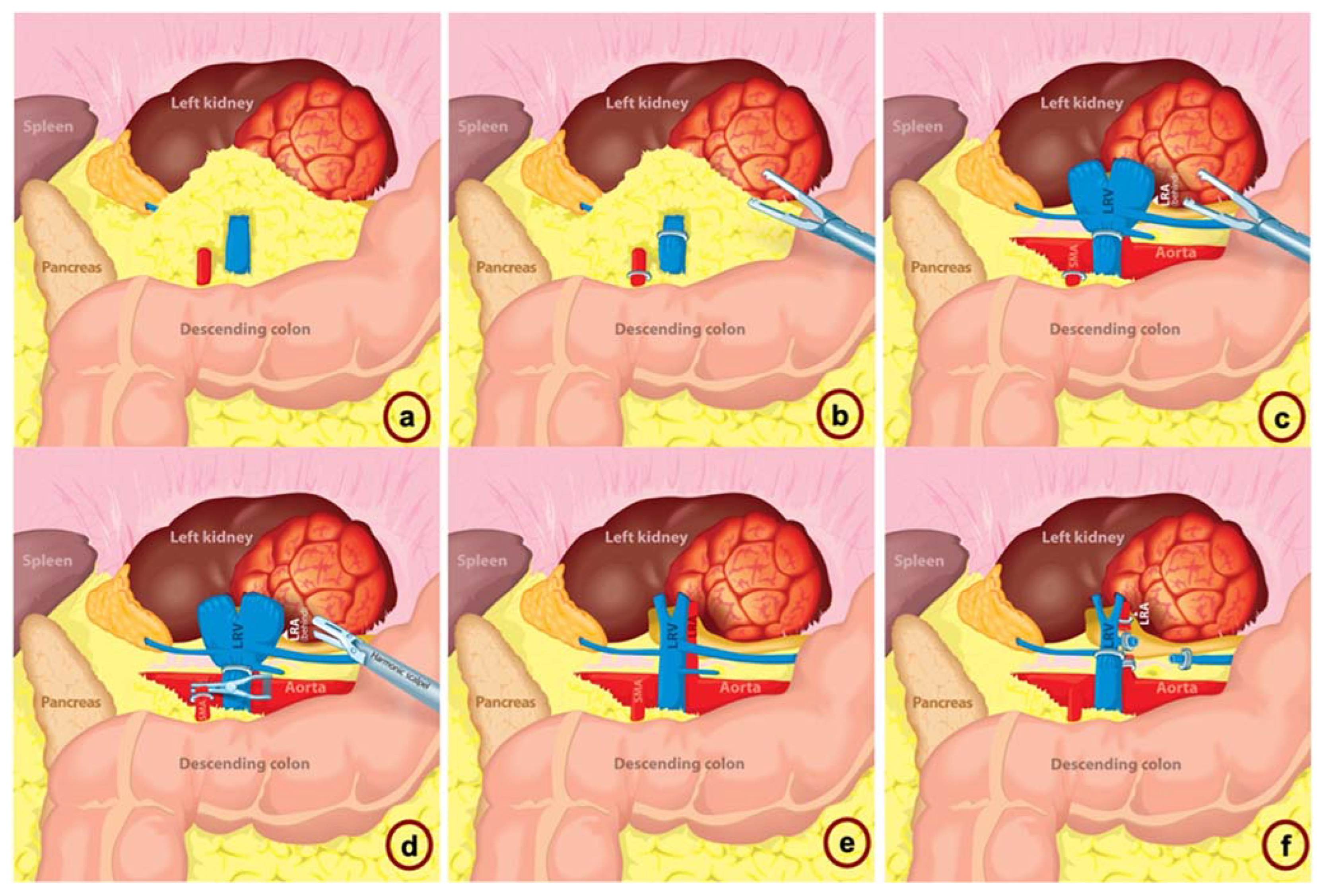 Jcm 12 00427 g001 Jcm 12 00427 g001