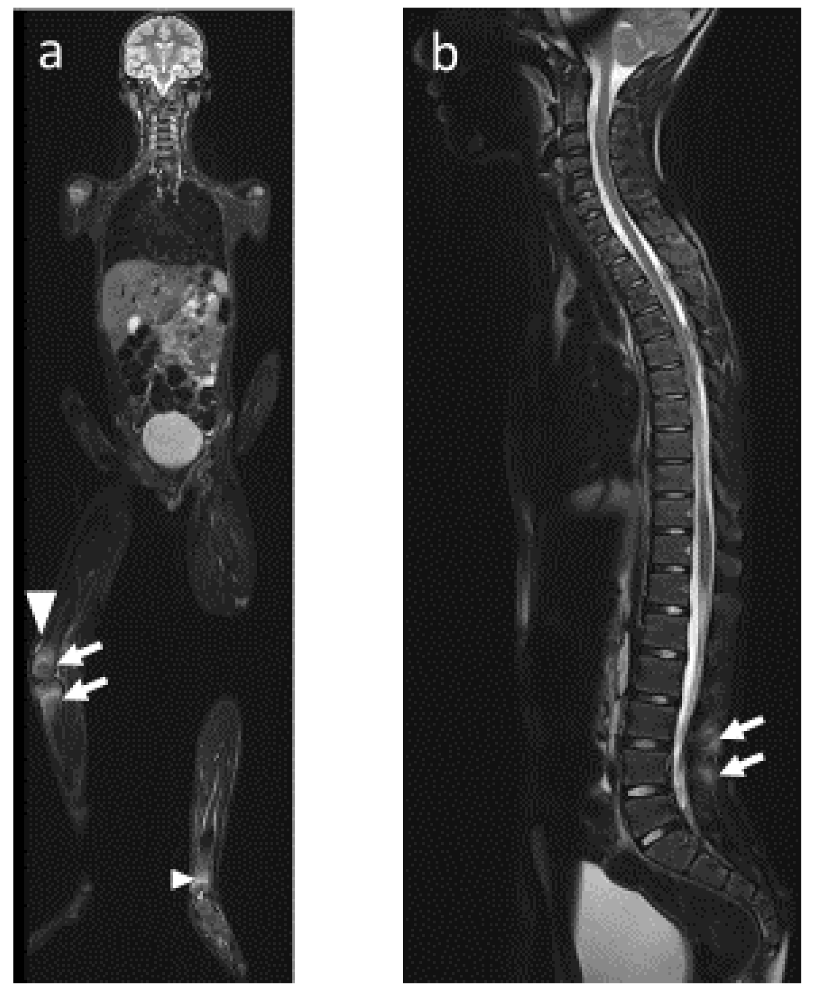 Jcm 12 00453 g005 Jcm 12 00453 g005