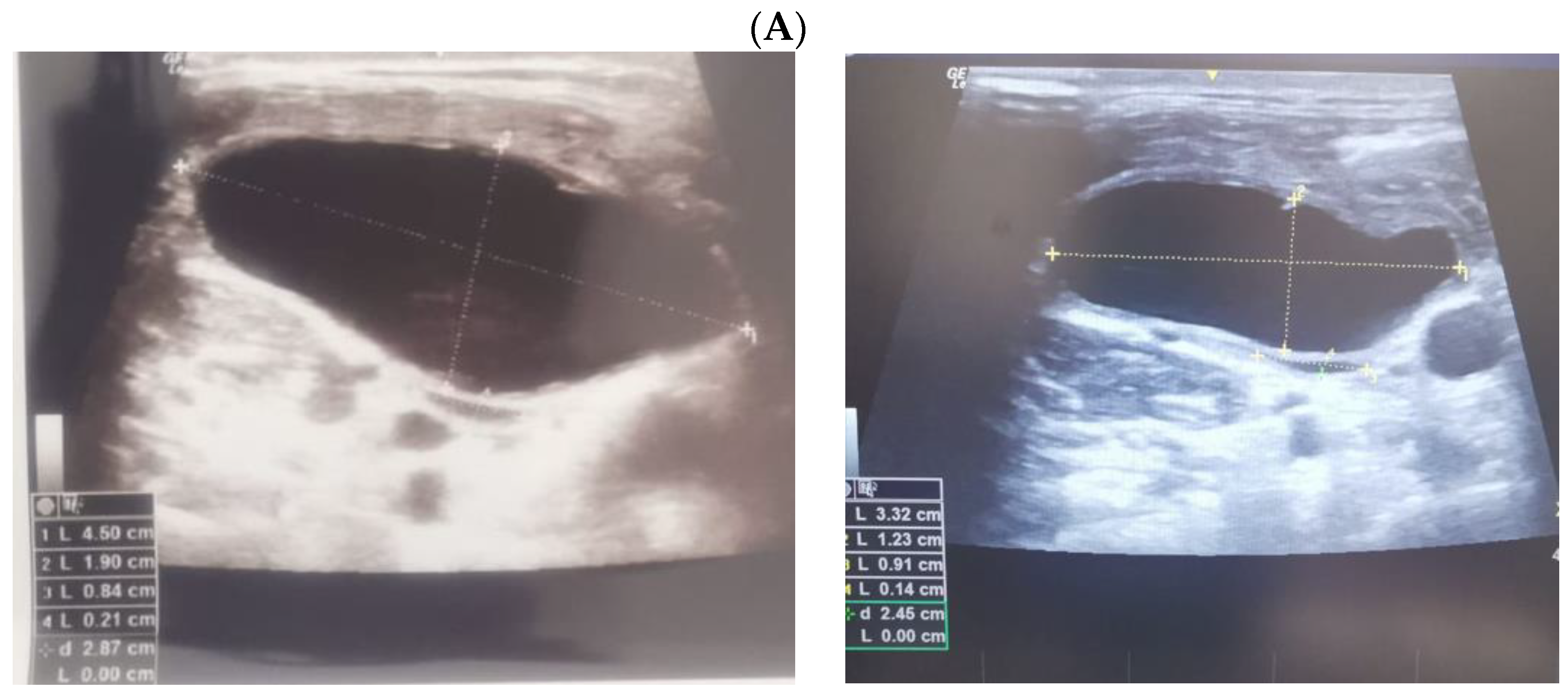 Jcm 12 00474 g004a Jcm 12 00474 g004a