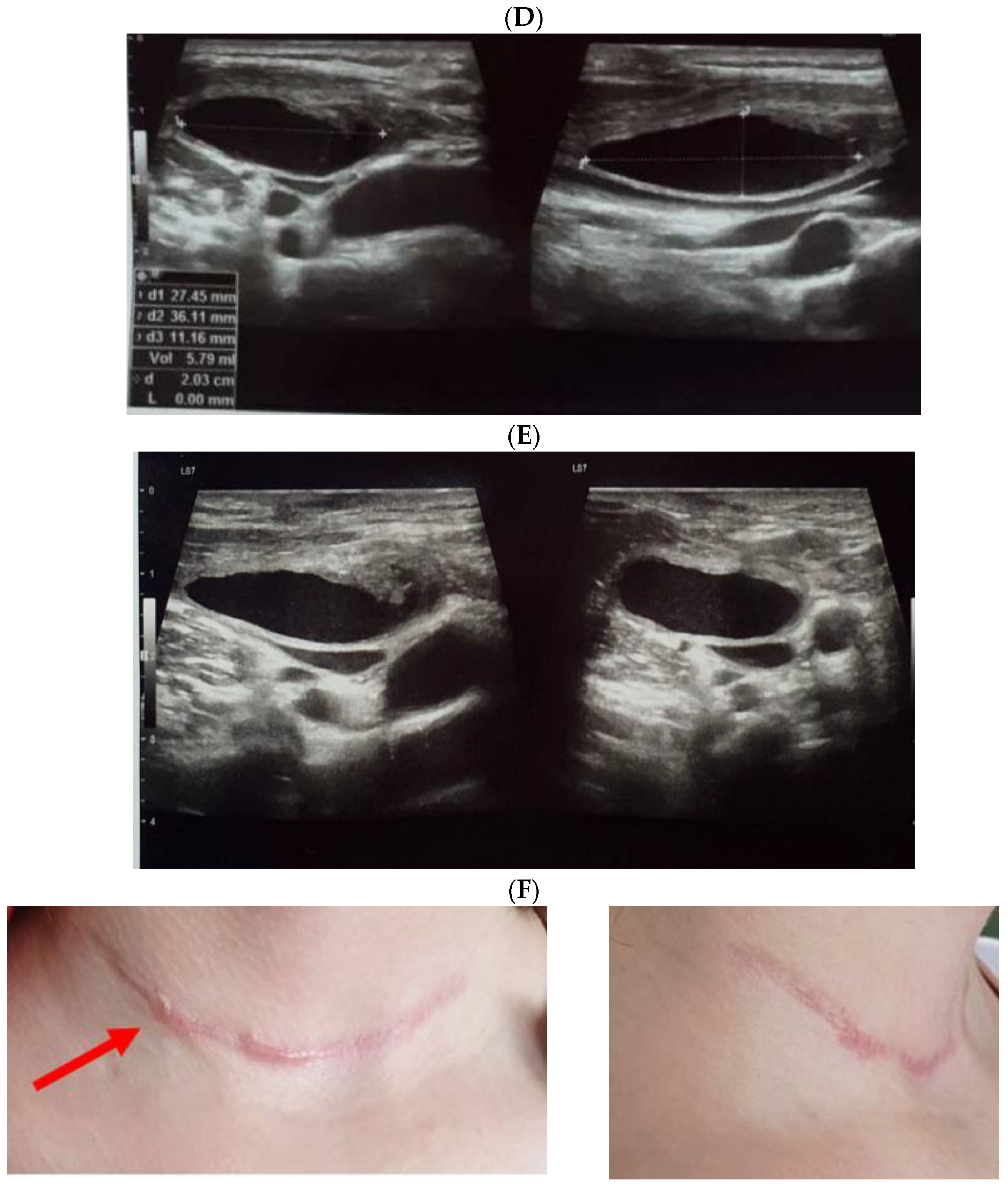 Jcm 12 00474 g004c Jcm 12 00474 g004c