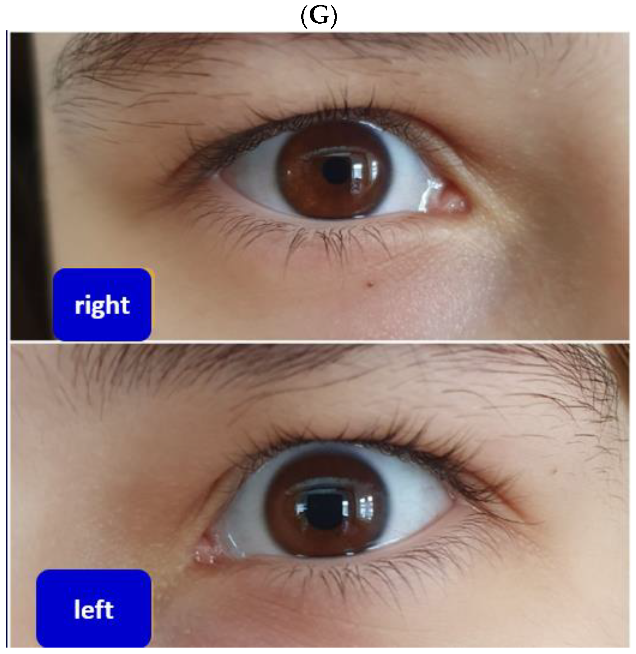 Jcm 12 00474 g004d Jcm 12 00474 g004d