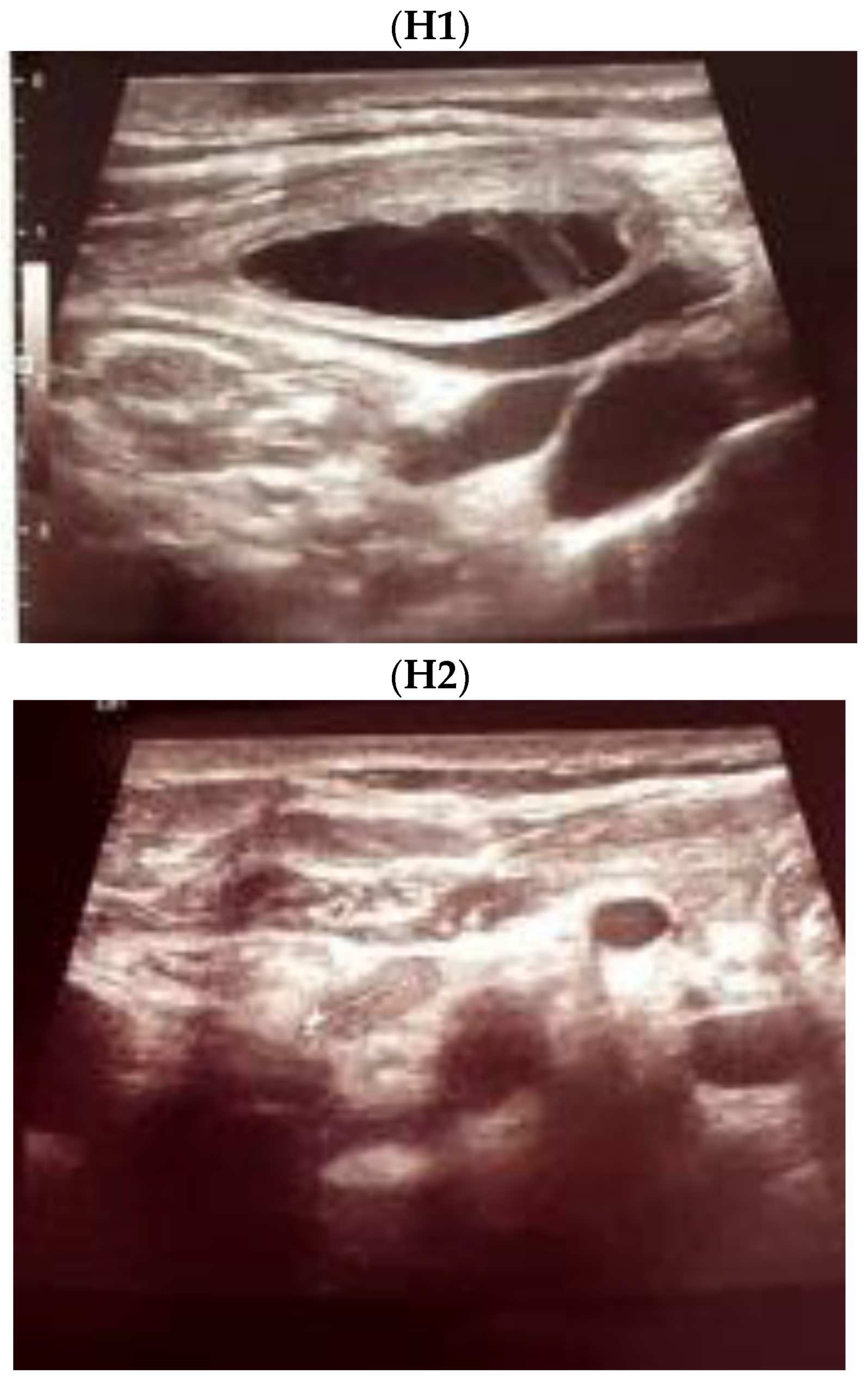 Jcm 12 00474 g004e Jcm 12 00474 g004e