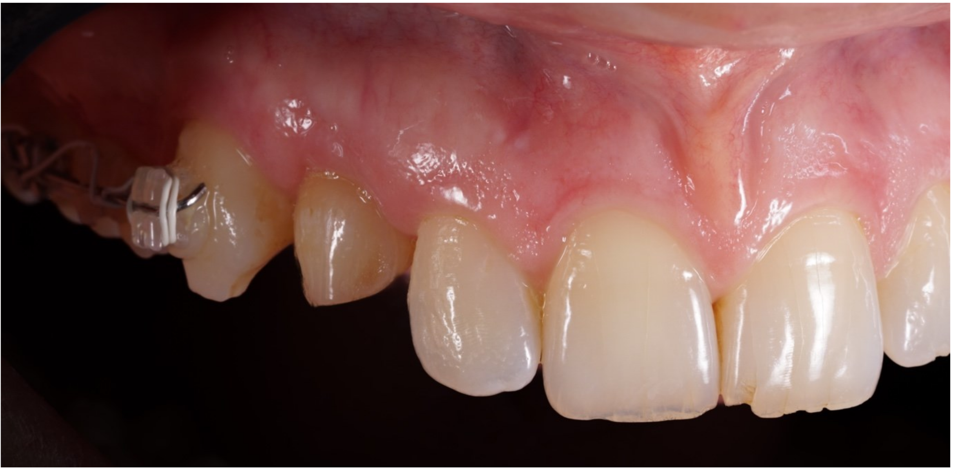 Jcm 12 00489 g002 Jcm 12 00489 g002