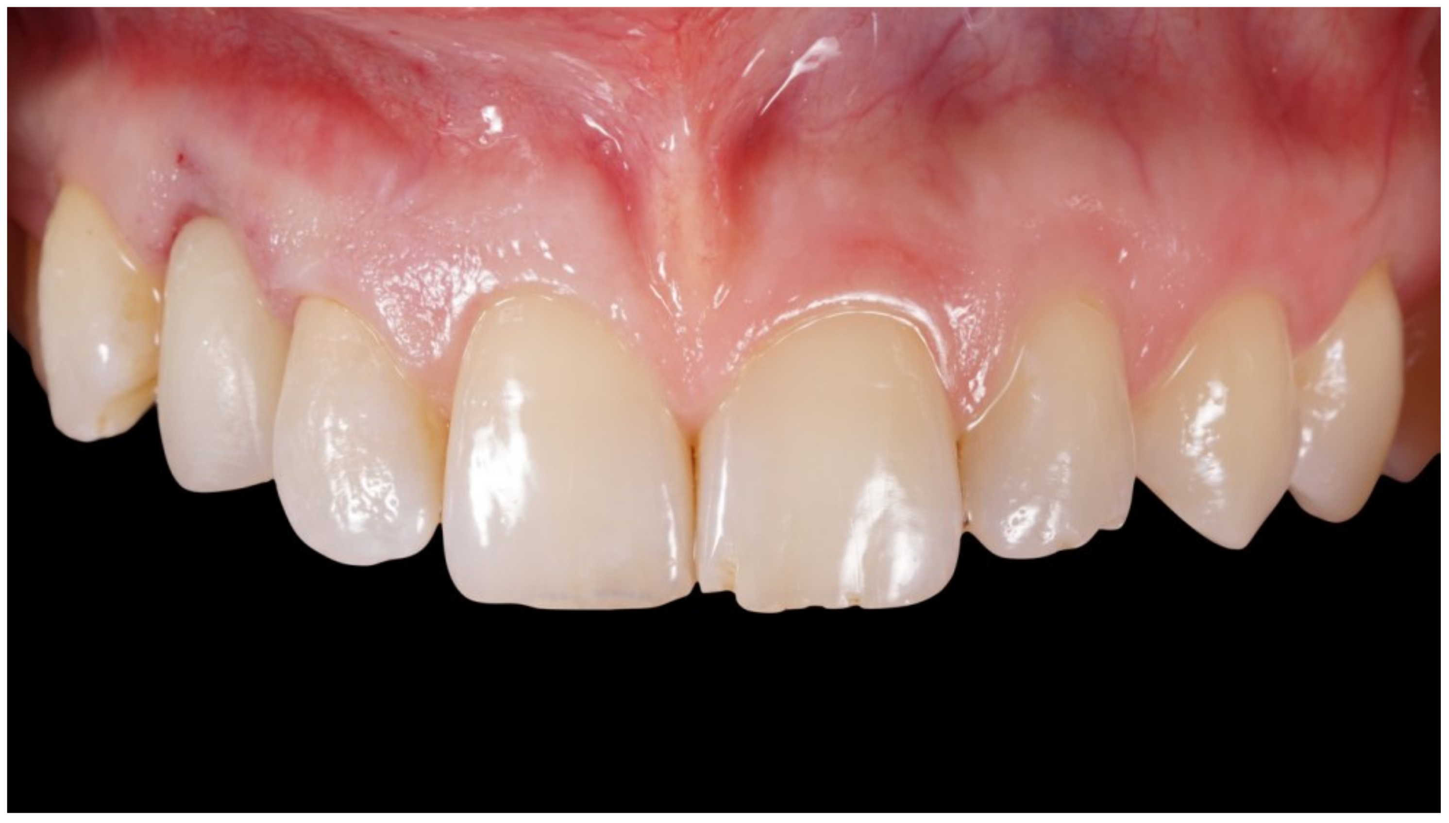 Jcm 12 00489 g004 Jcm 12 00489 g004