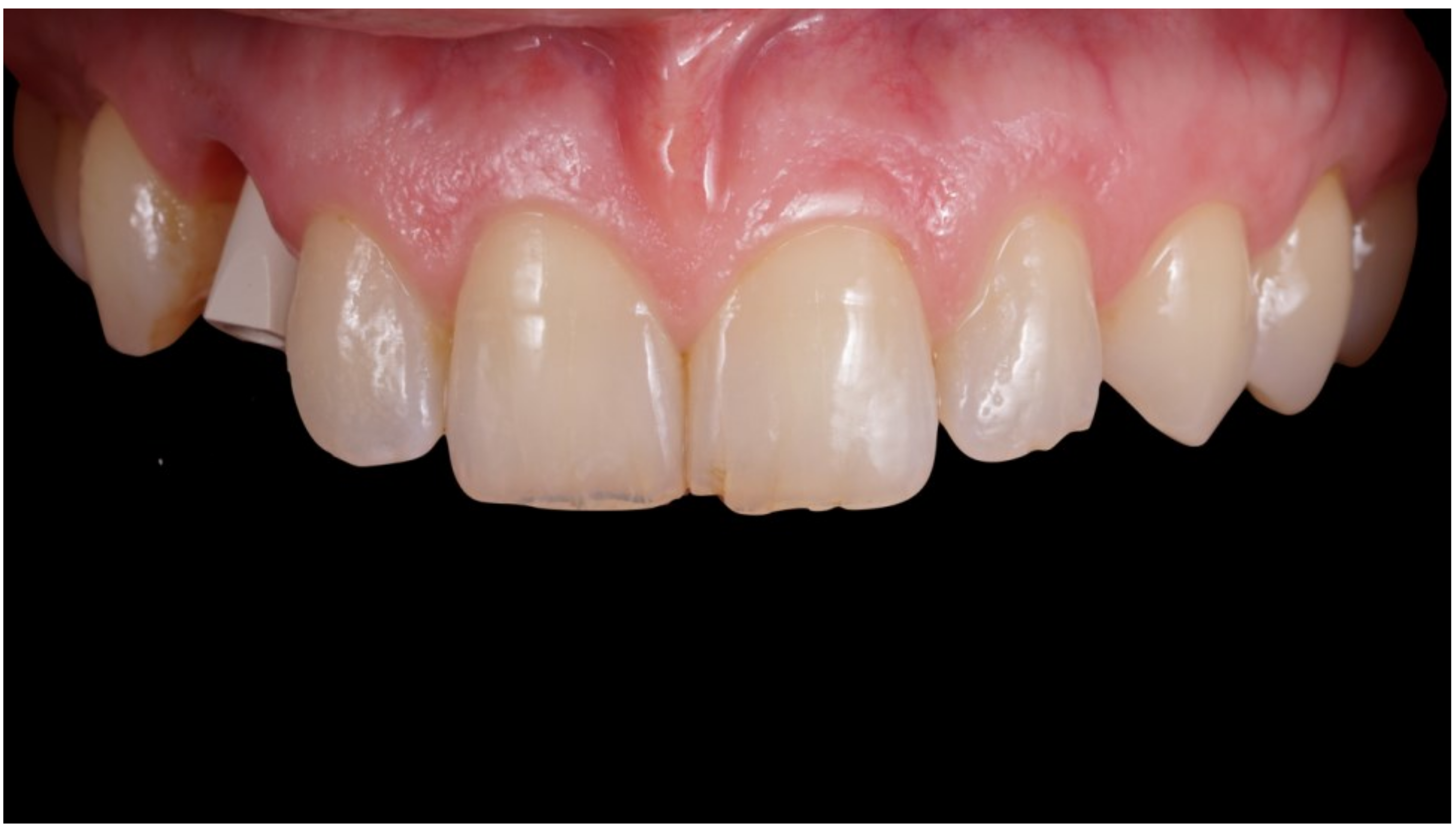 Jcm 12 00489 g007 Jcm 12 00489 g007