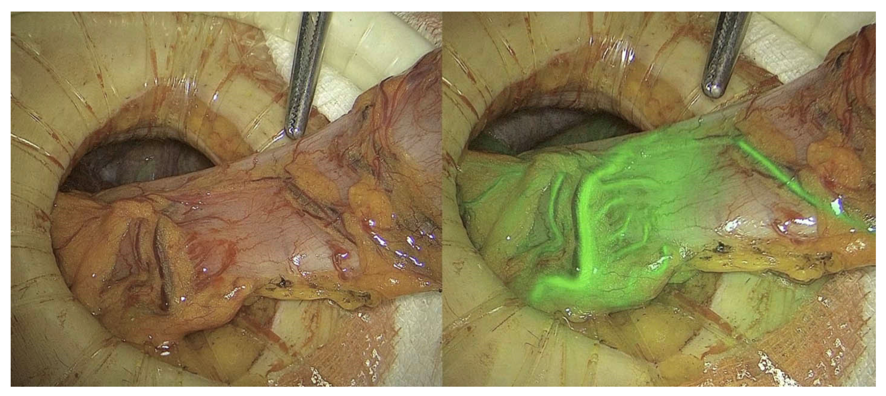 Jcm 12 00494 g002 Jcm 12 00494 g002