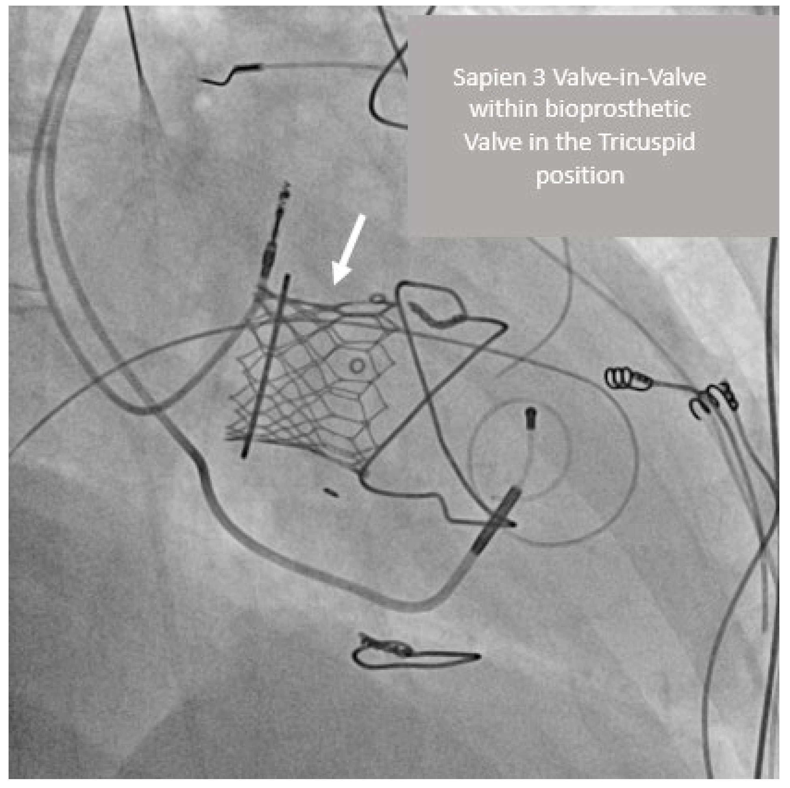 Jcm 12 00521 g002 Jcm 12 00521 g002