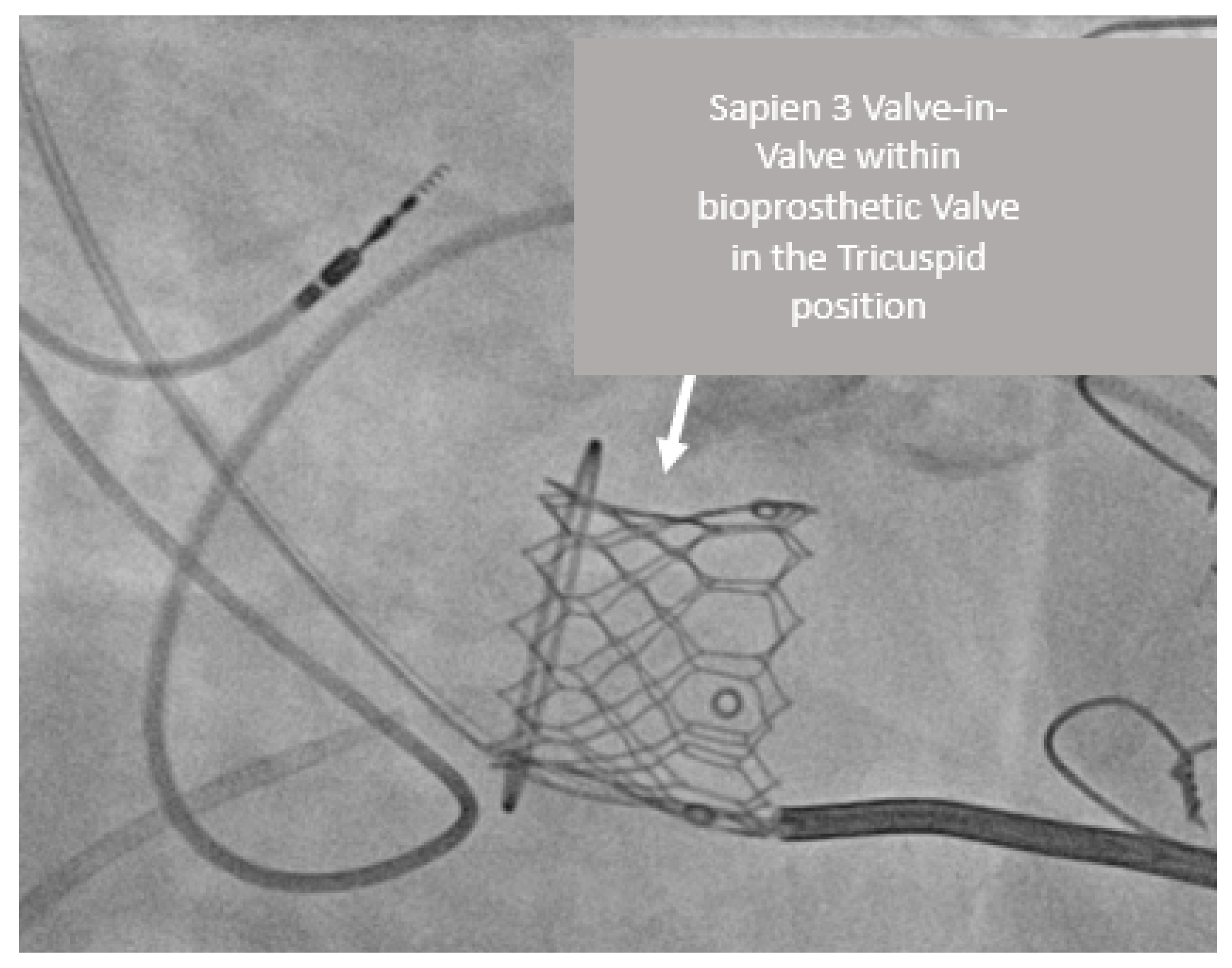 Jcm 12 00521 g003 Jcm 12 00521 g003