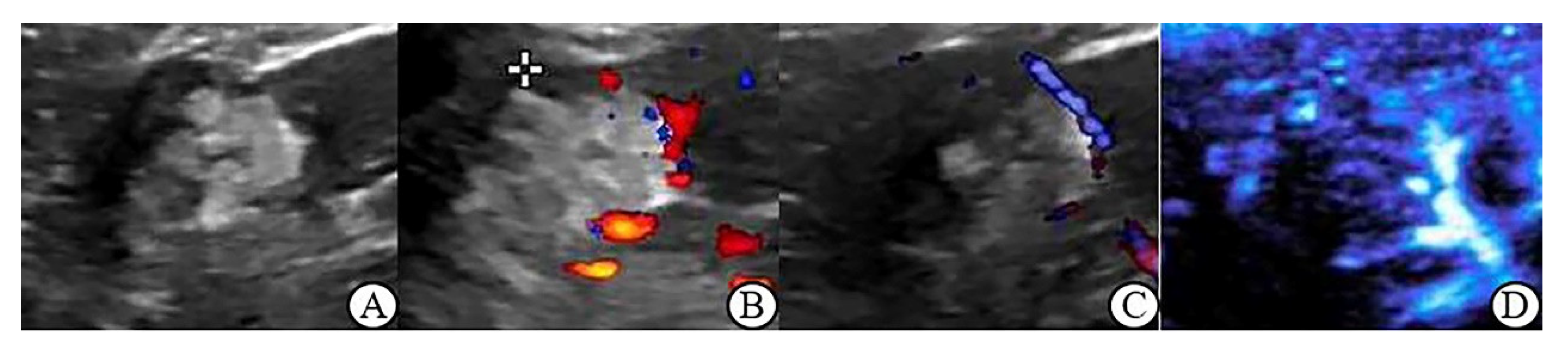 Jcm 12 00566 g001 Jcm 12 00566 g001