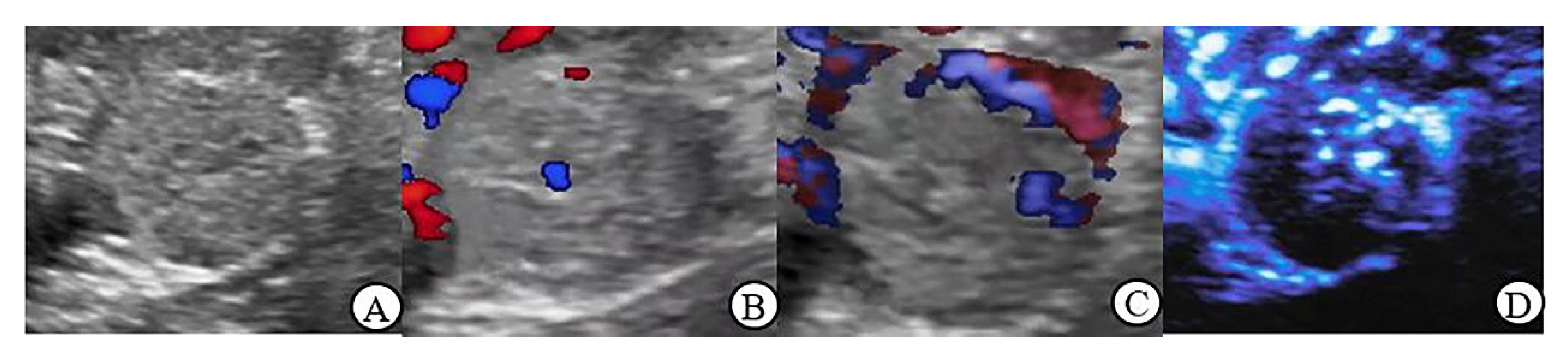 Jcm 12 00566 g002 Jcm 12 00566 g002