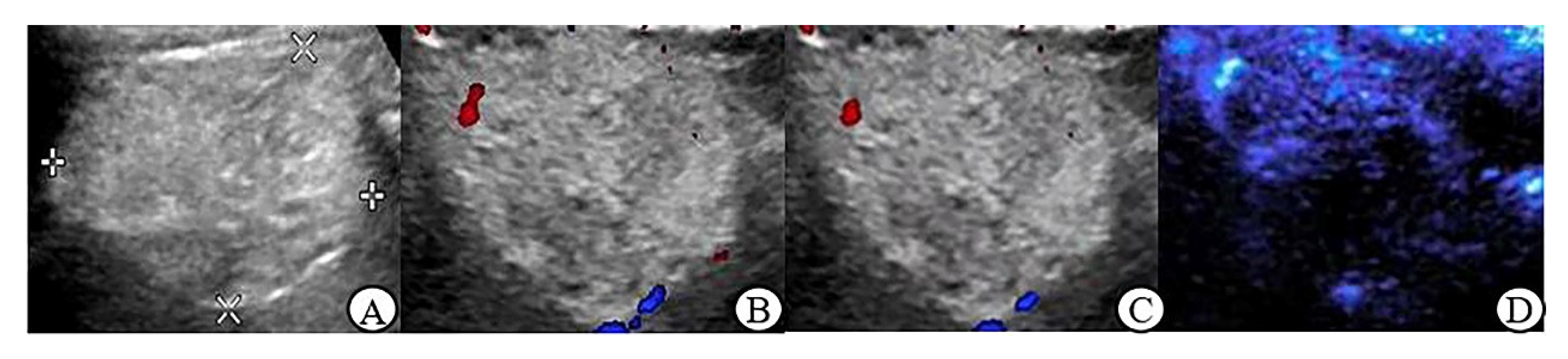 Jcm 12 00566 g003 Jcm 12 00566 g003