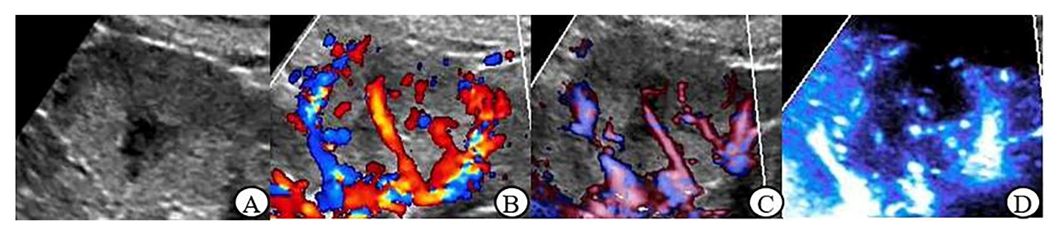 Jcm 12 00566 g004 Jcm 12 00566 g004