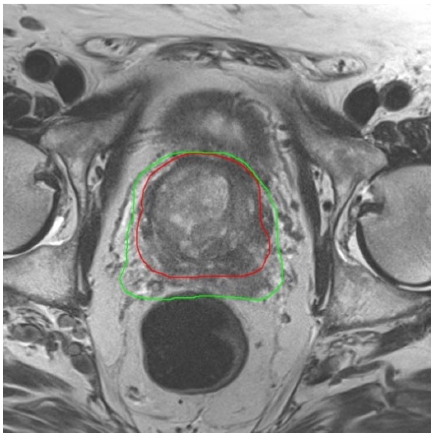 Jcm 12 00574 g002 Jcm 12 00574 g002