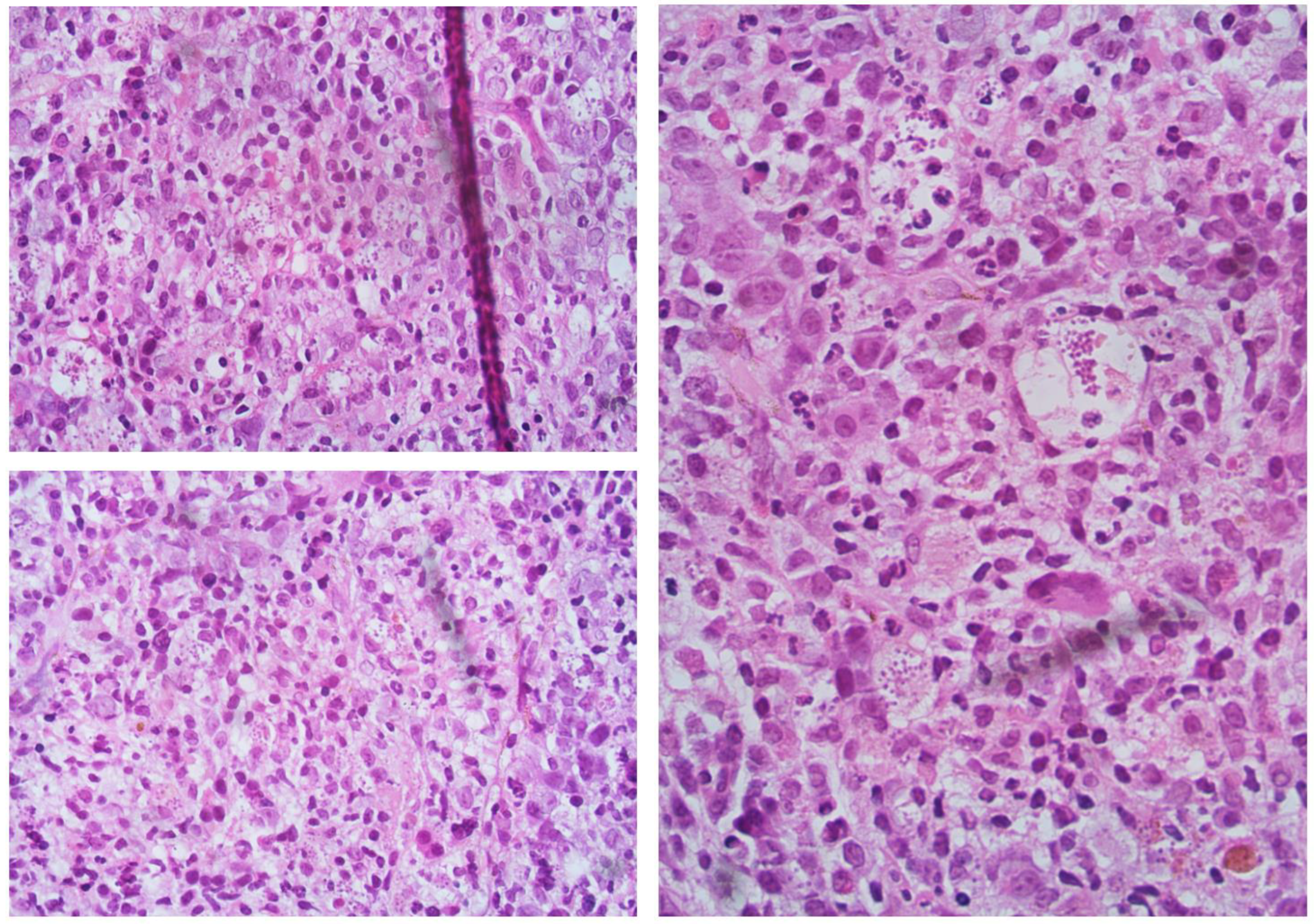 Jcm 12 00578 g001 Jcm 12 00578 g001