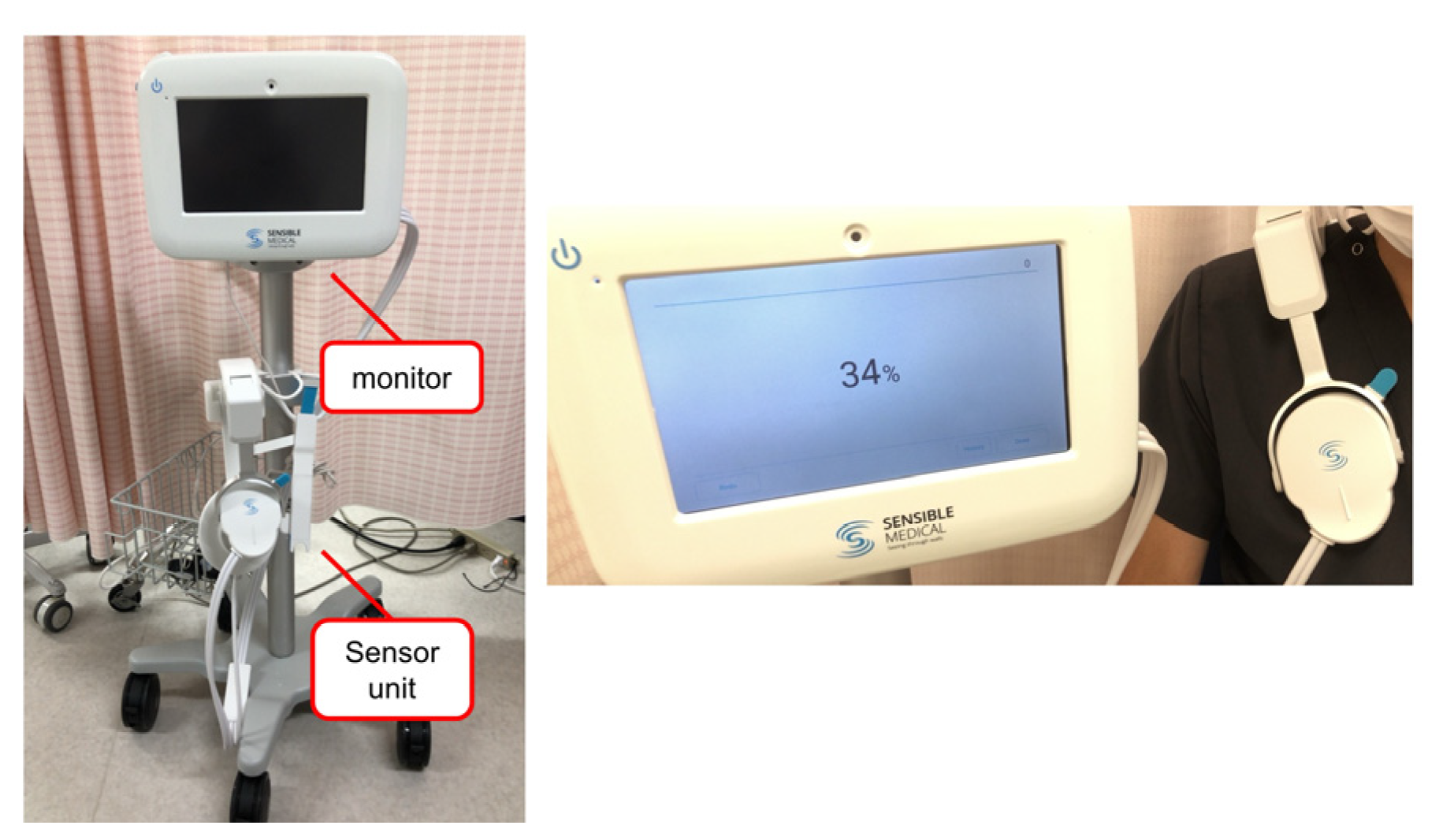 Correlation between Remote Dielectric Sensing and Chest X