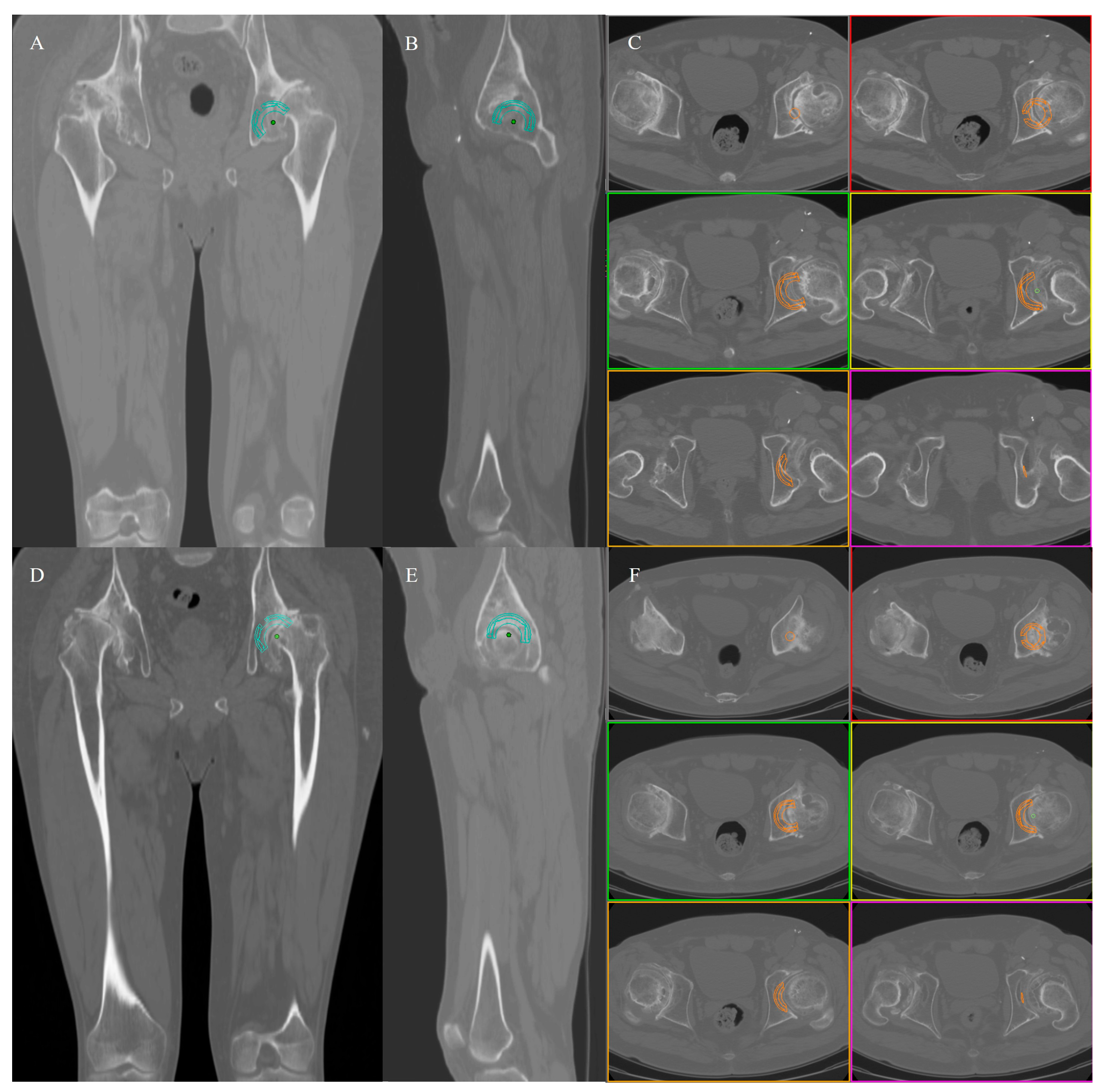 Jcm 12 00606 g001 Jcm 12 00606 g001