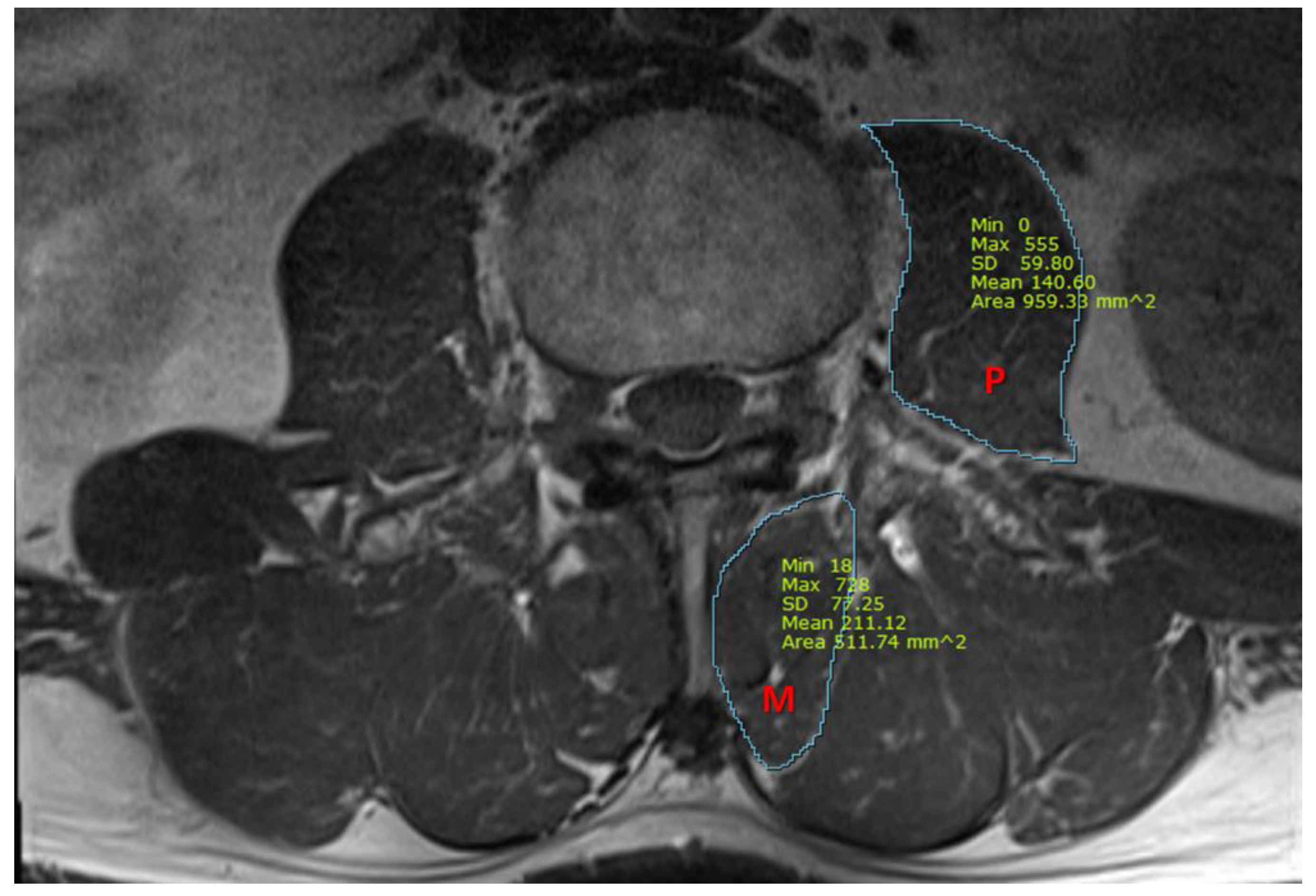 Jcm 12 00612 g001 Jcm 12 00612 g001