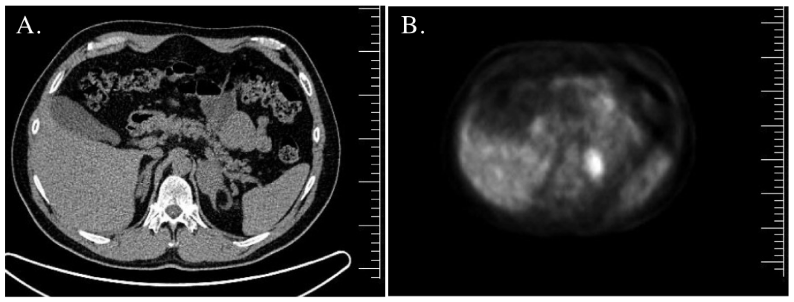 Jcm 12 00653 g002 Jcm 12 00653 g002