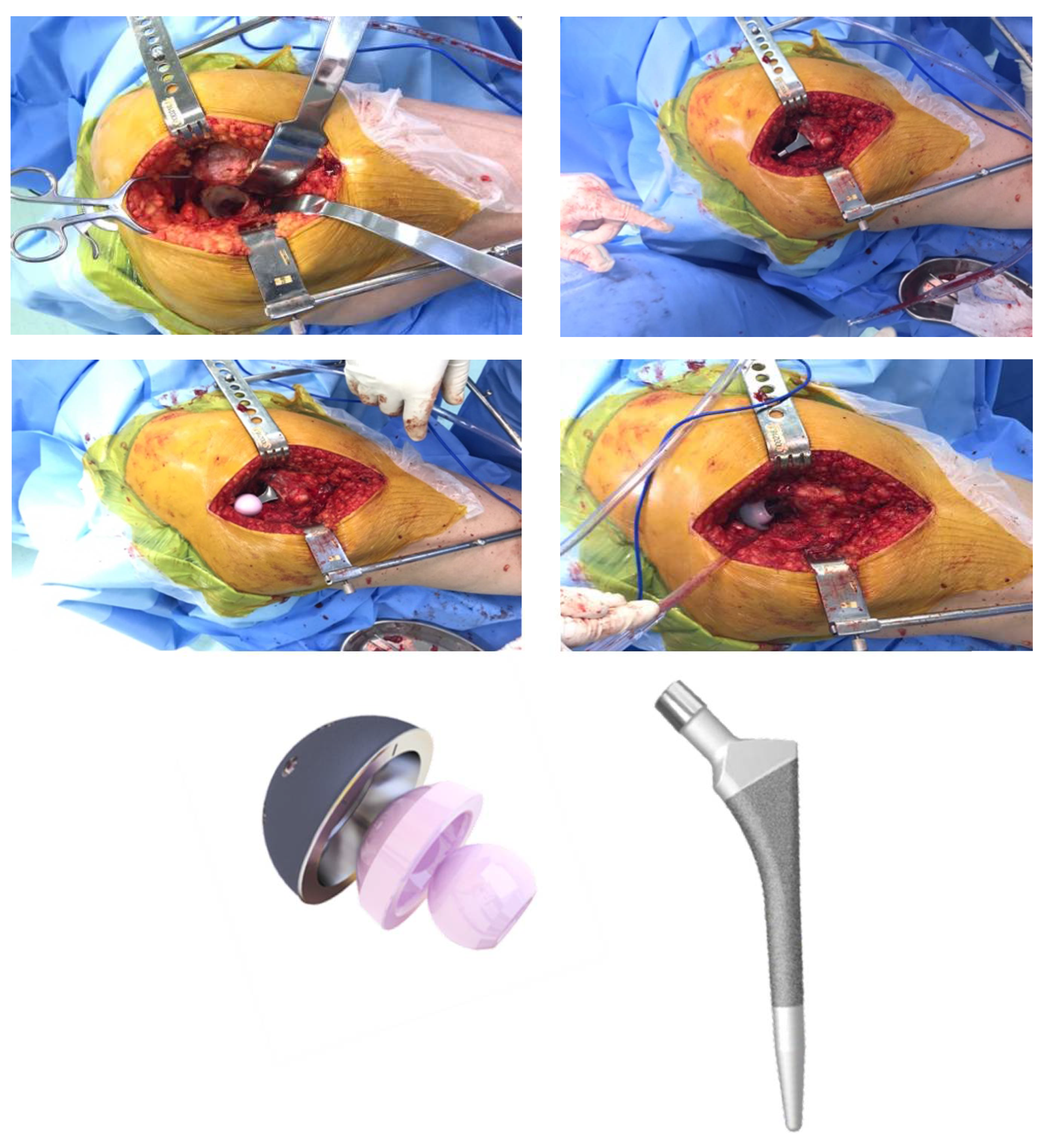 Jcm 12 00670 g001 Jcm 12 00670 g001