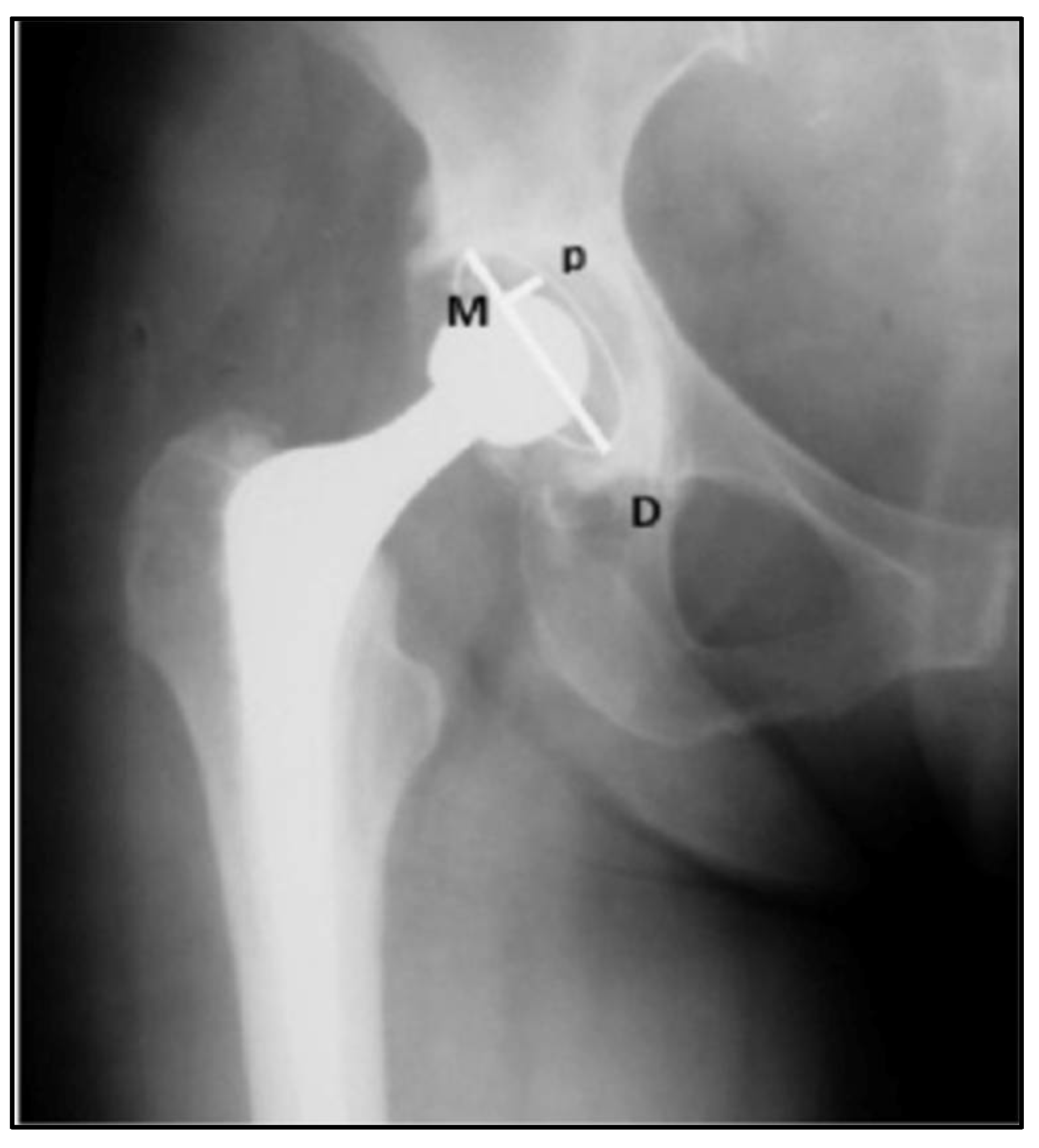 Jcm 12 00670 g003 Jcm 12 00670 g003