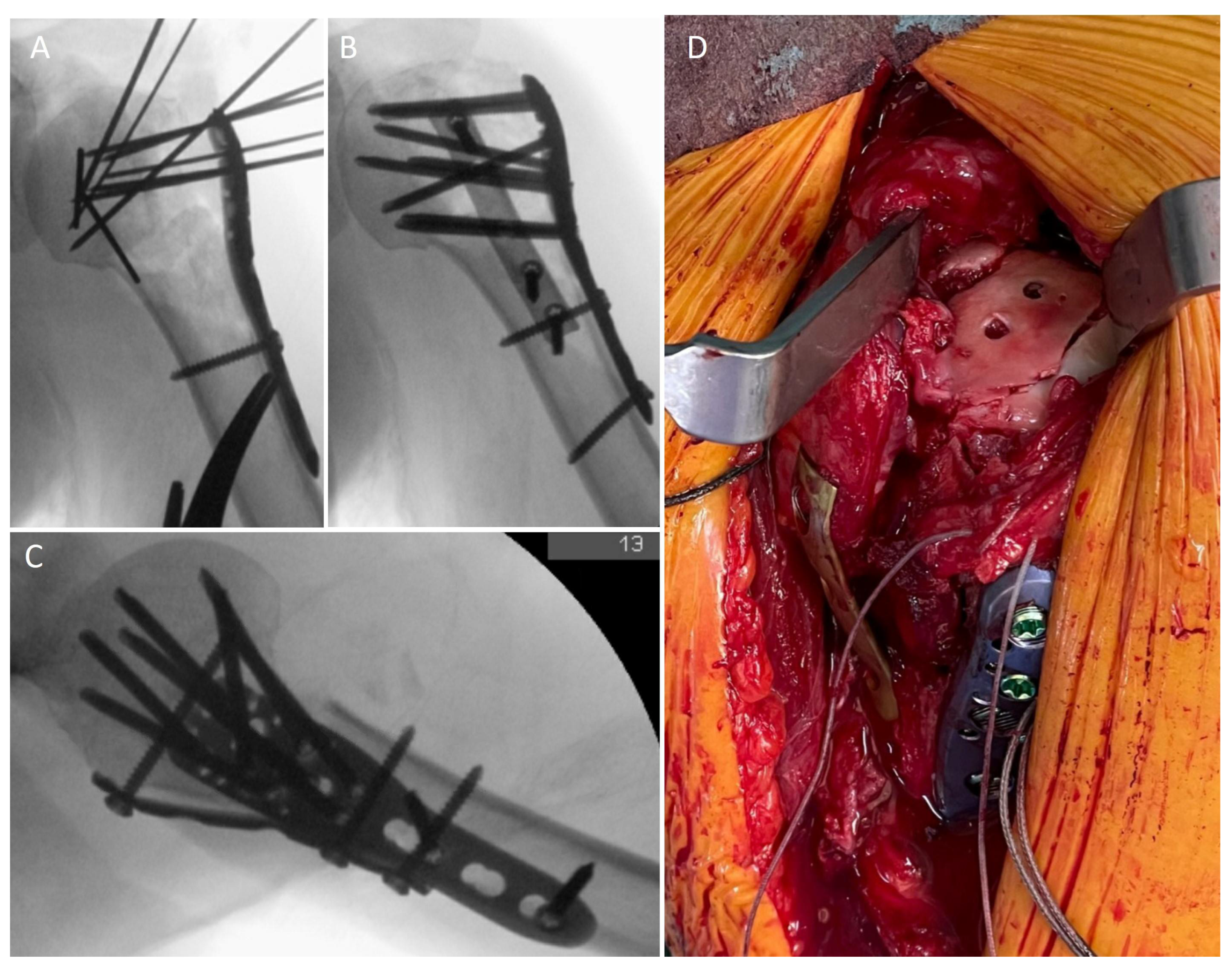 Jcm 12 00696 g002 Jcm 12 00696 g002